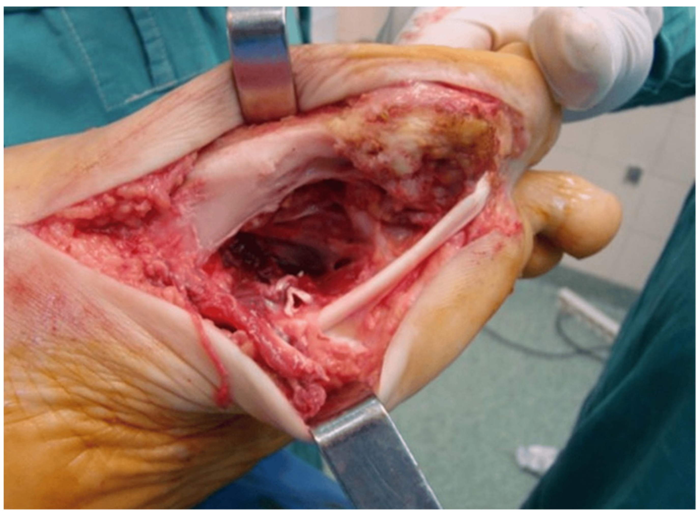 Medicina 60 01675 g003