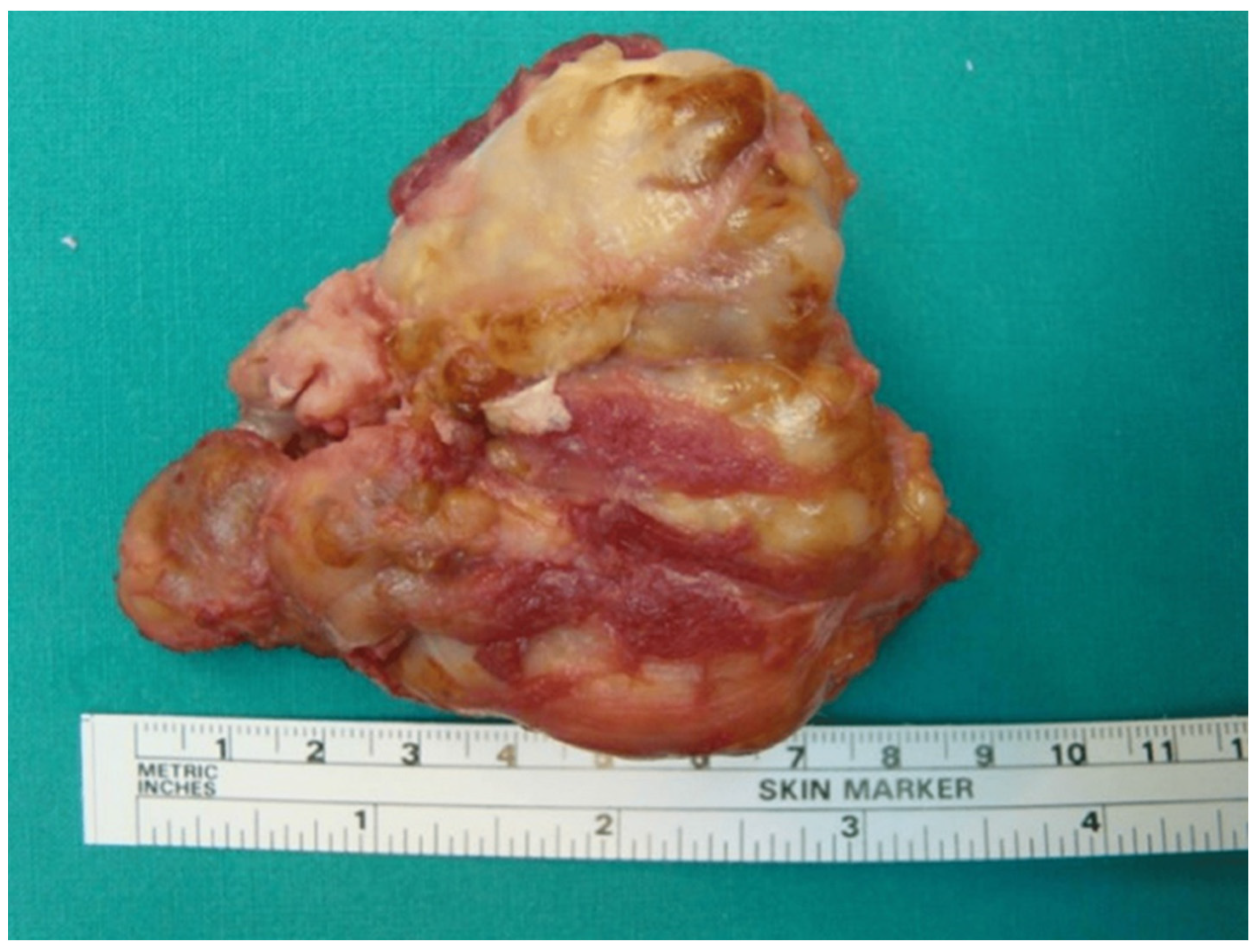 Medicina 60 01675 g004