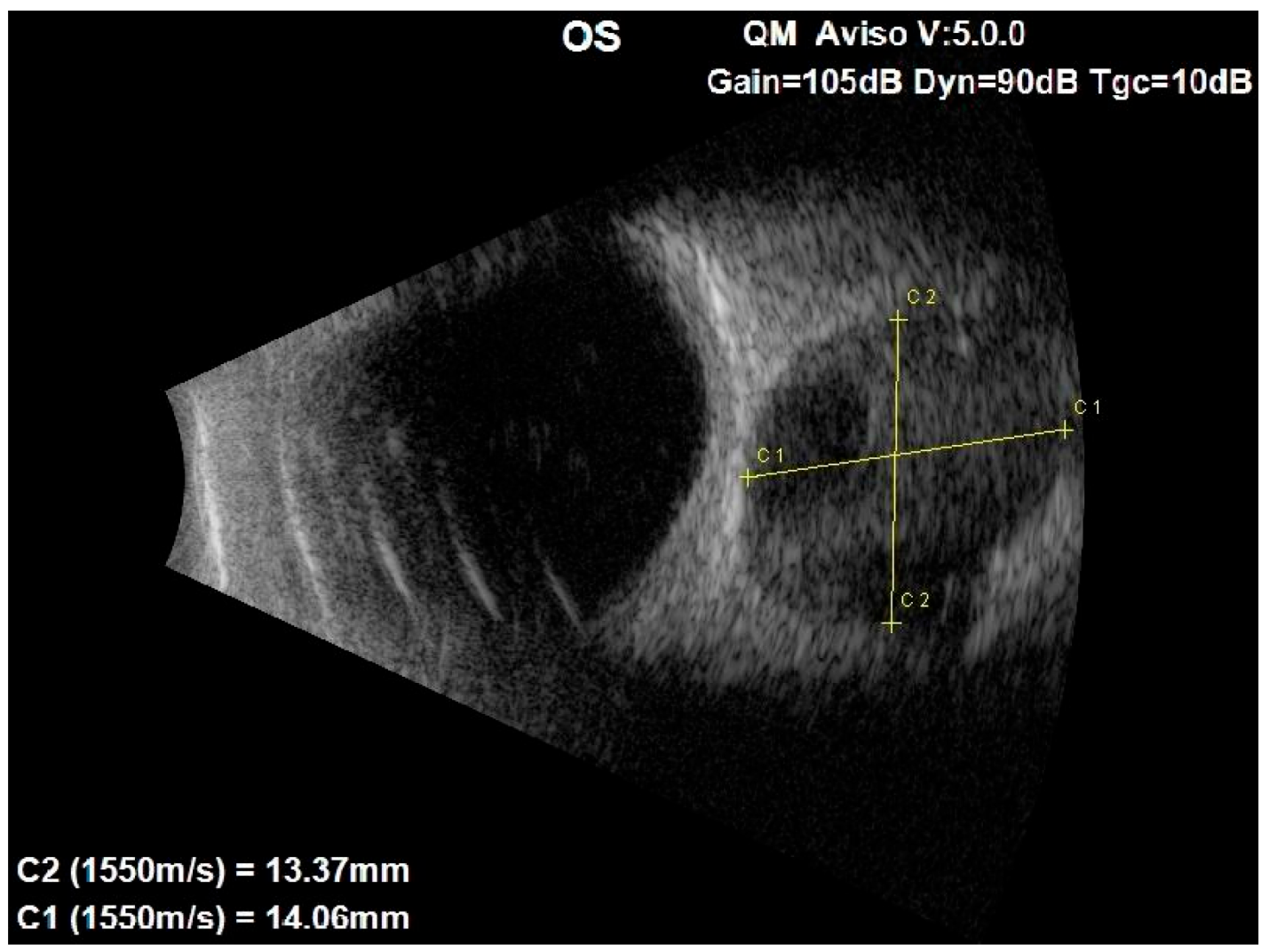 Medicina 60 01687 g001