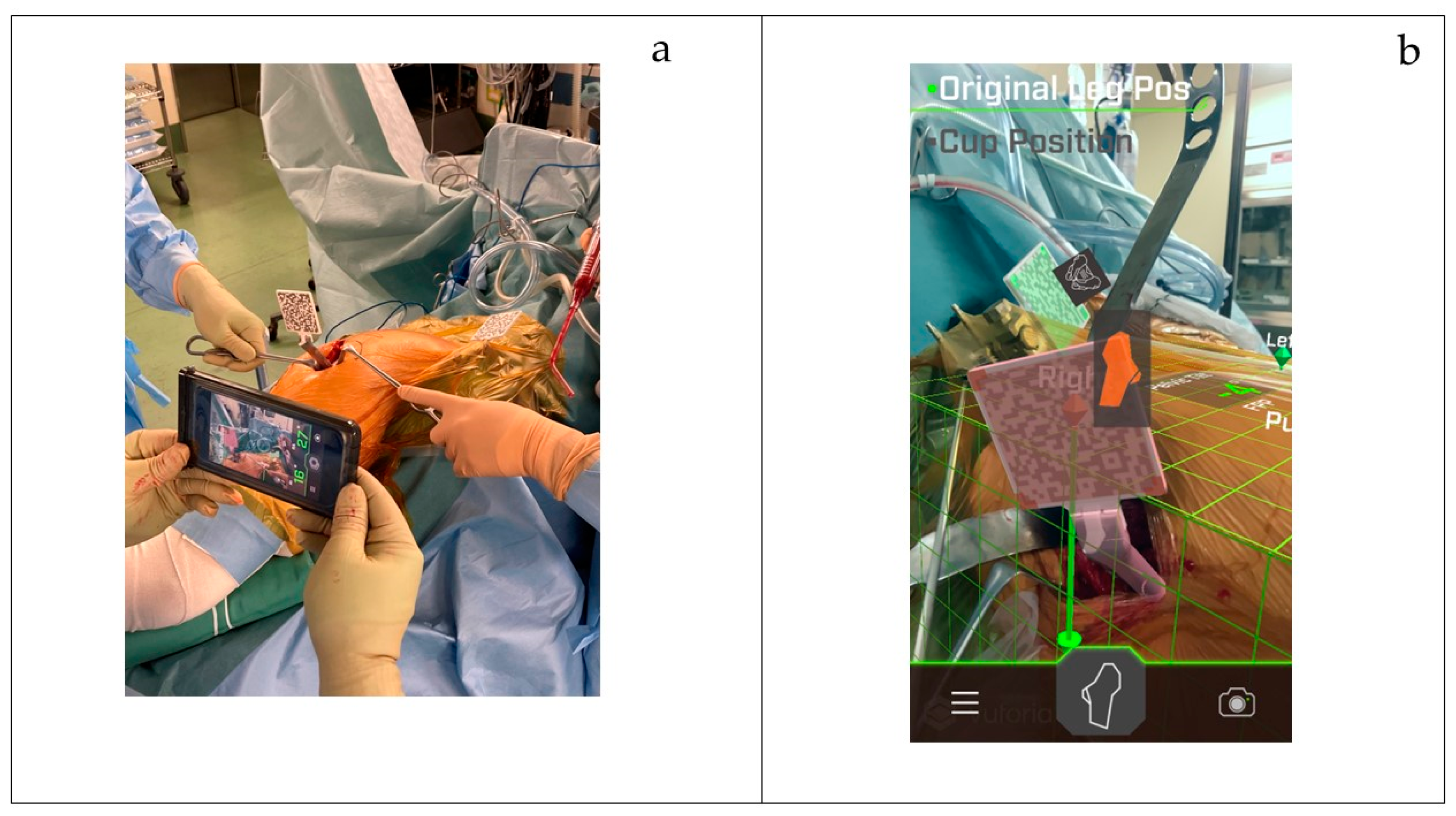 Medicina 60 01721 g004