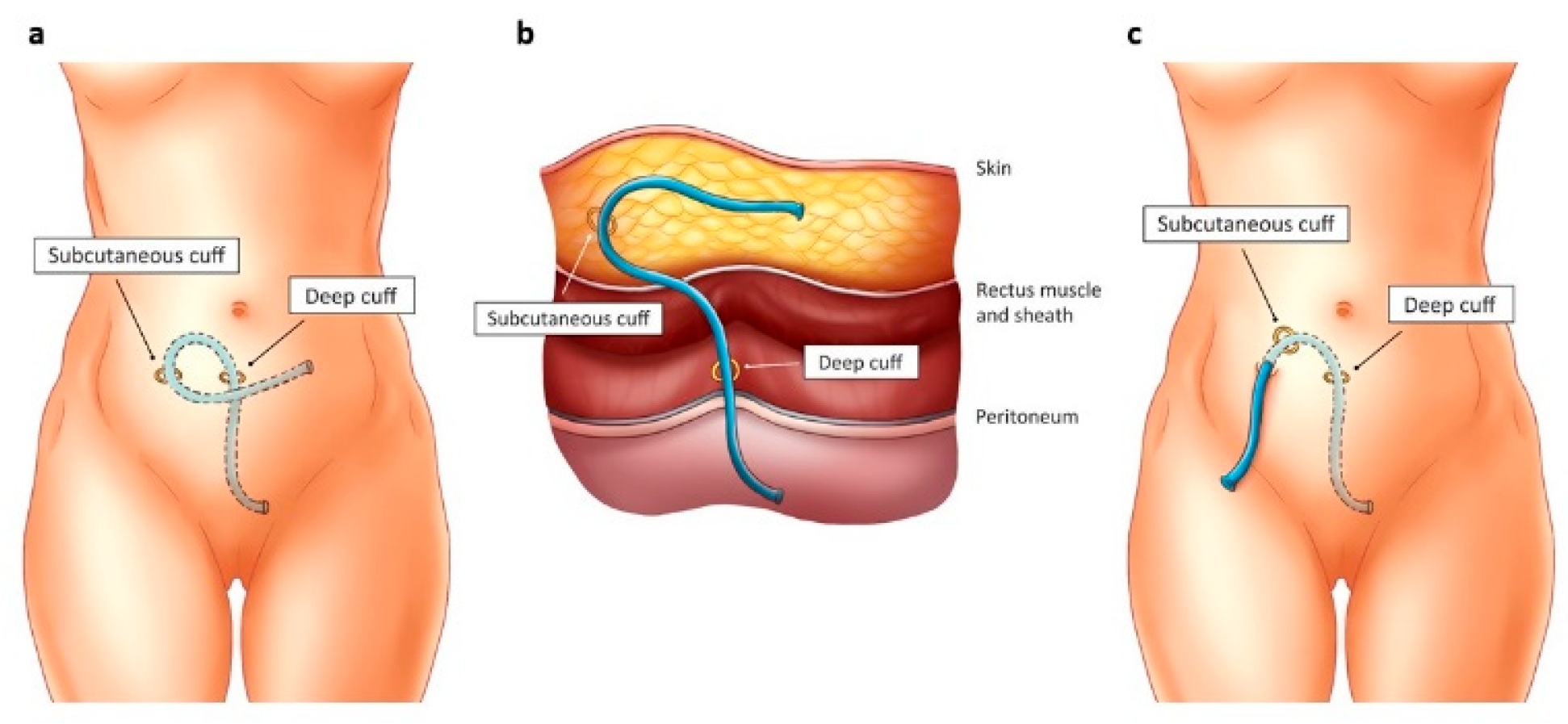 Medicina 60 01723 g001