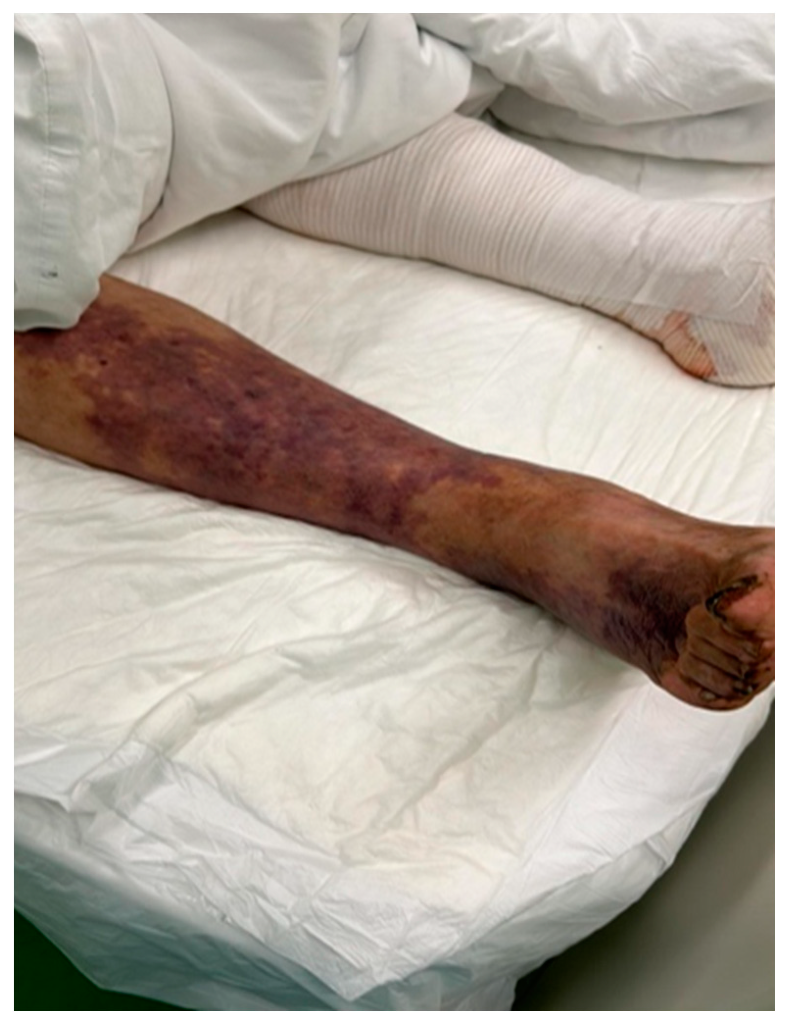 Medicina 60 01748 g004