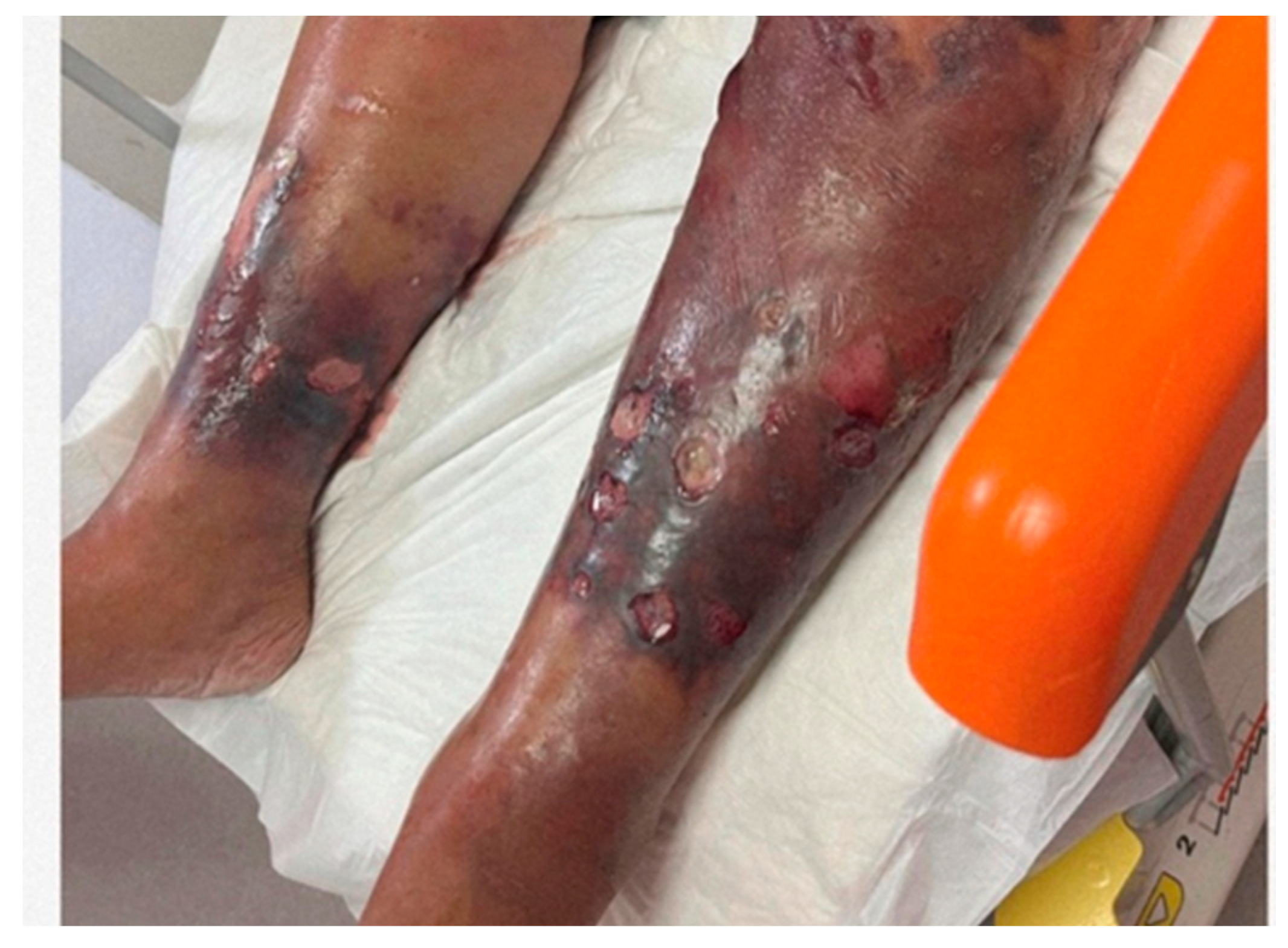 Medicina 60 01748 g005