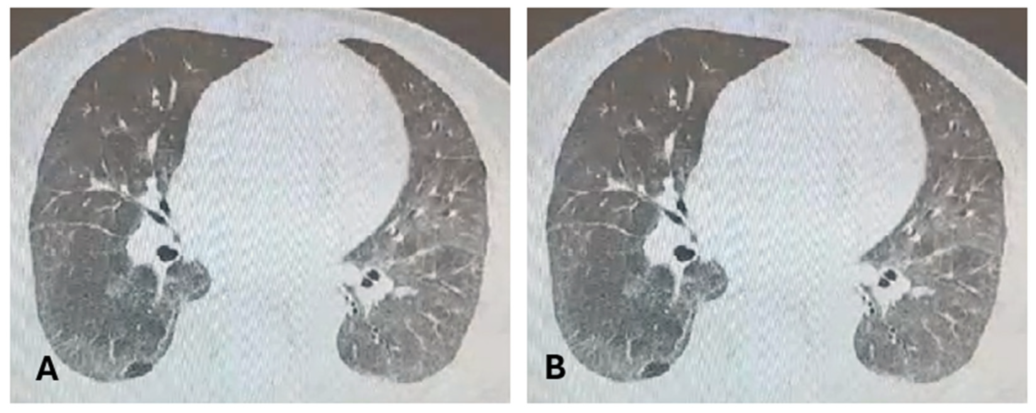 Medicina 60 01756 g004