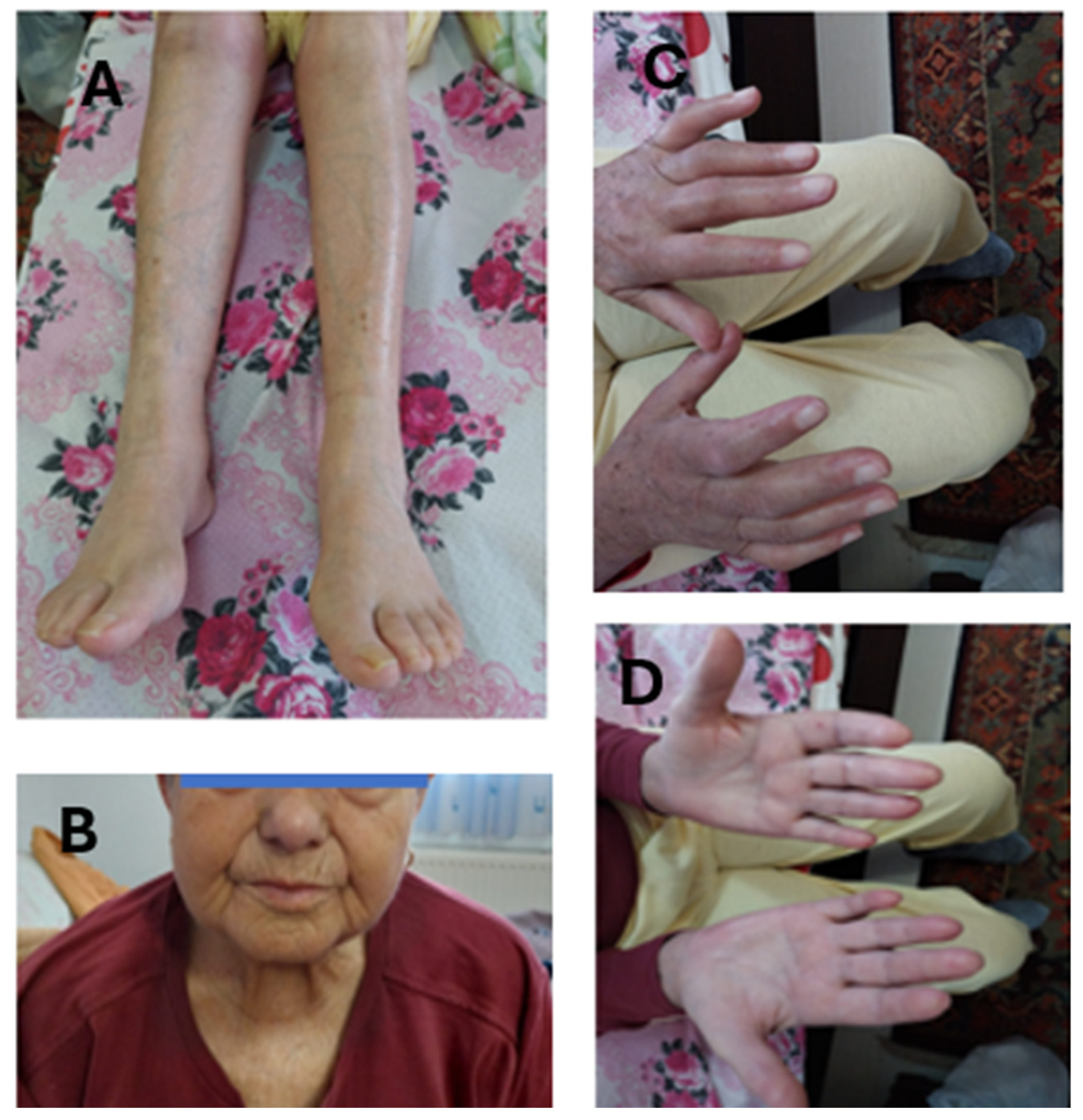 Medicina 60 01756 g006