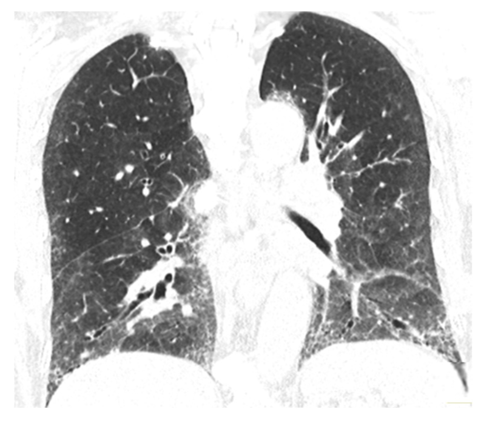 Medicina 60 01756 g007