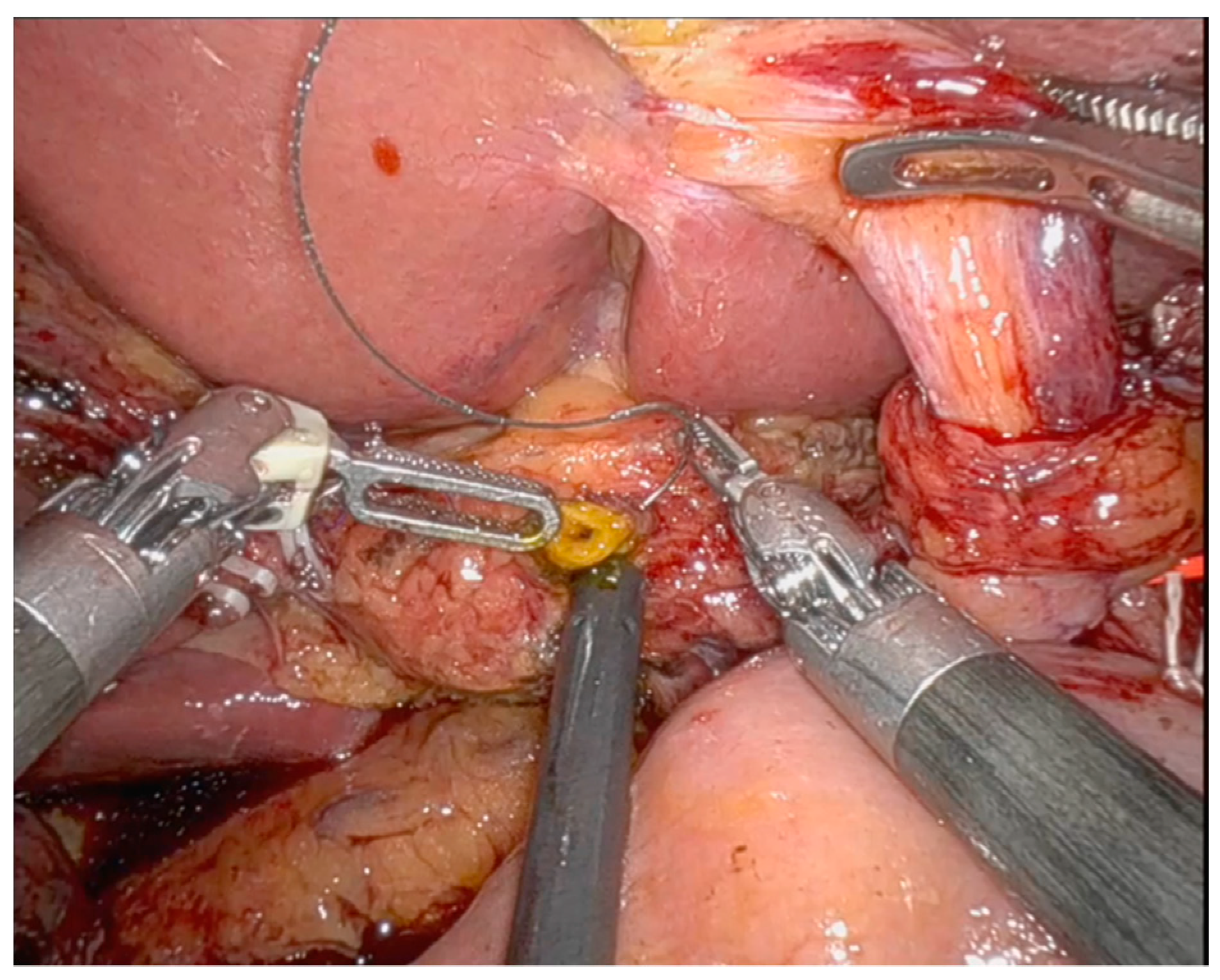 Medicina 60 01798 g002 Medicina 60 01798 g002