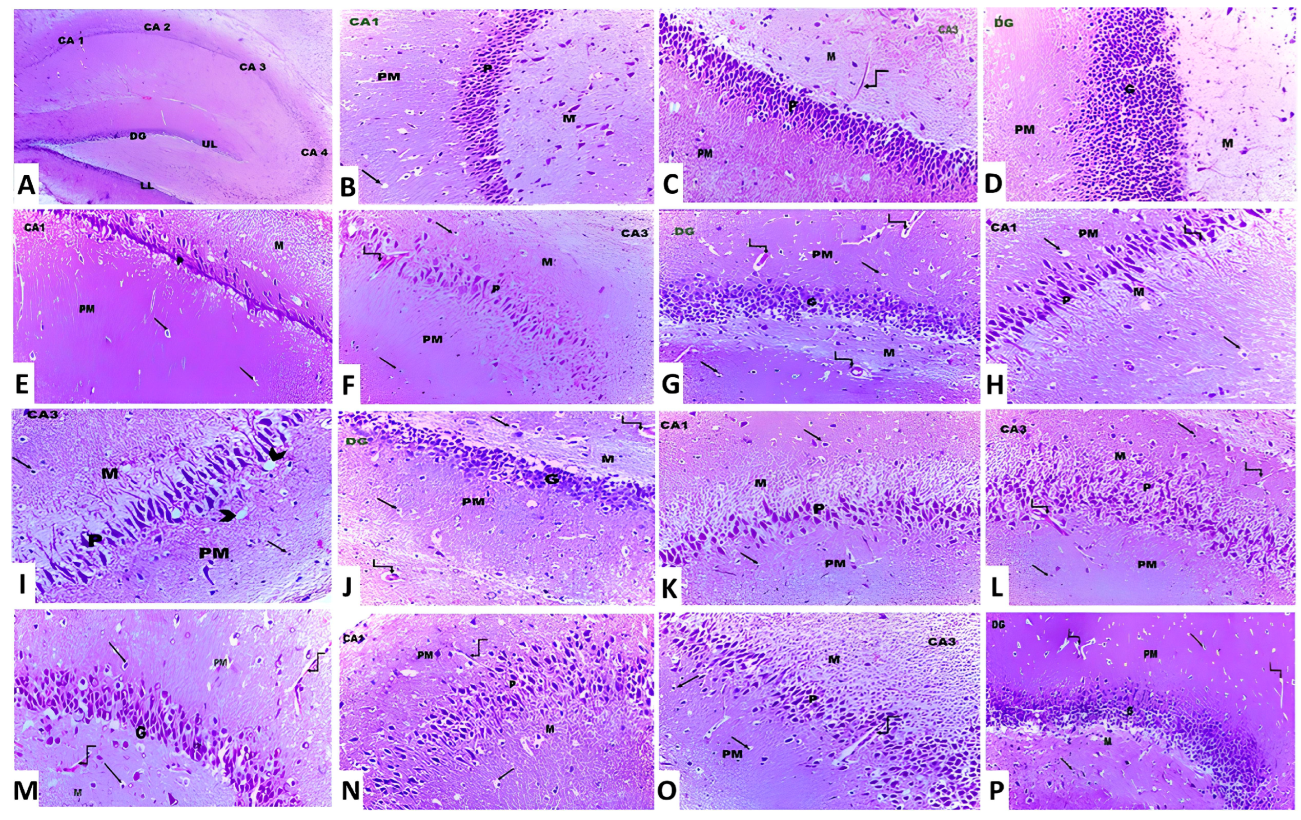Medicina 60 01805 g011