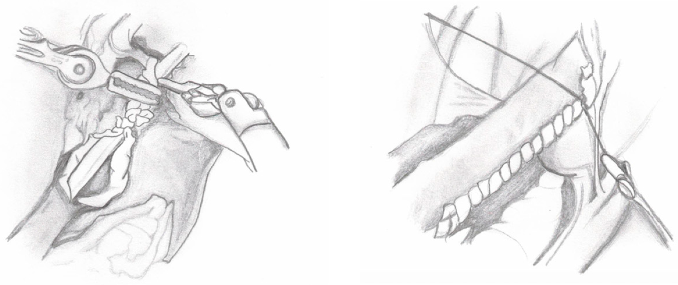 Medicina 60 01837 g004