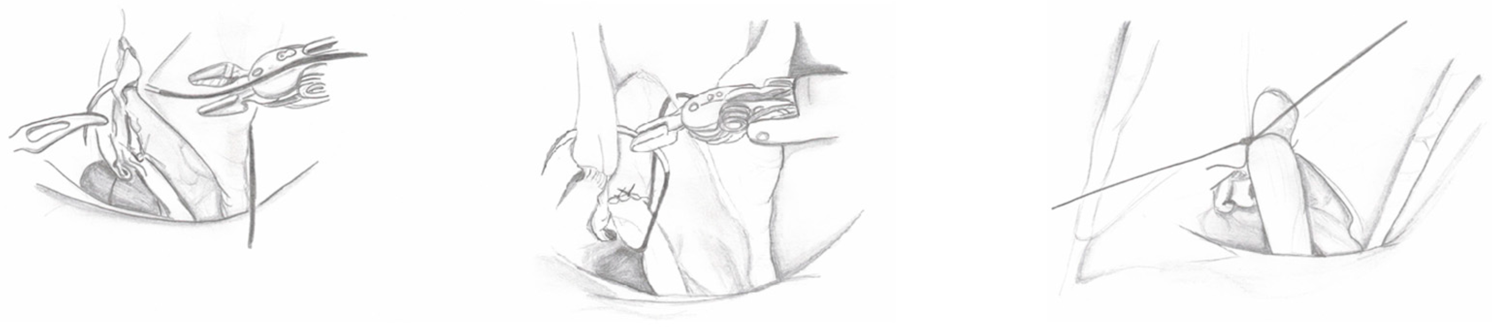 Medicina 60 01837 g006