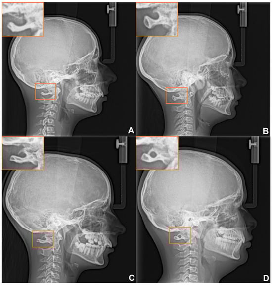 Medicina 60 01853 g002
