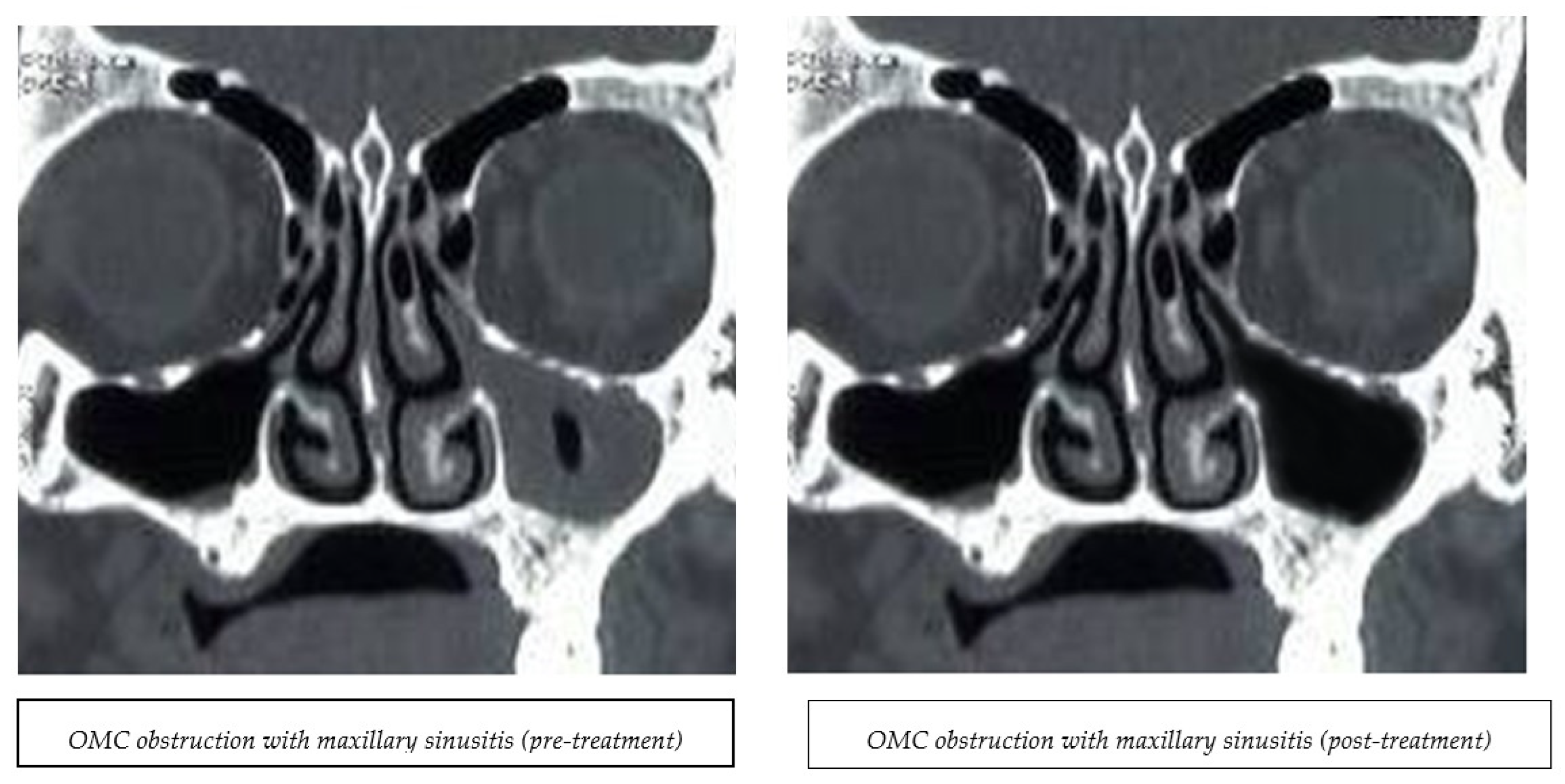 Medicina 60 01868 g002 Medicina 60 01868 g002