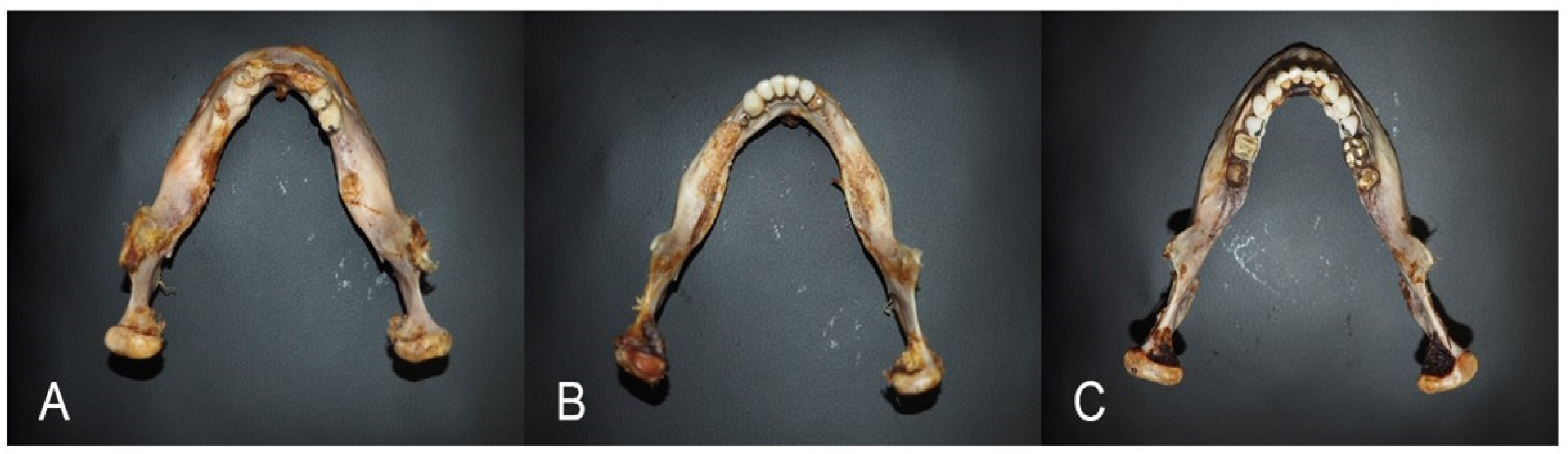 Medicina 60 01925 g004 Medicina 60 01925 g004