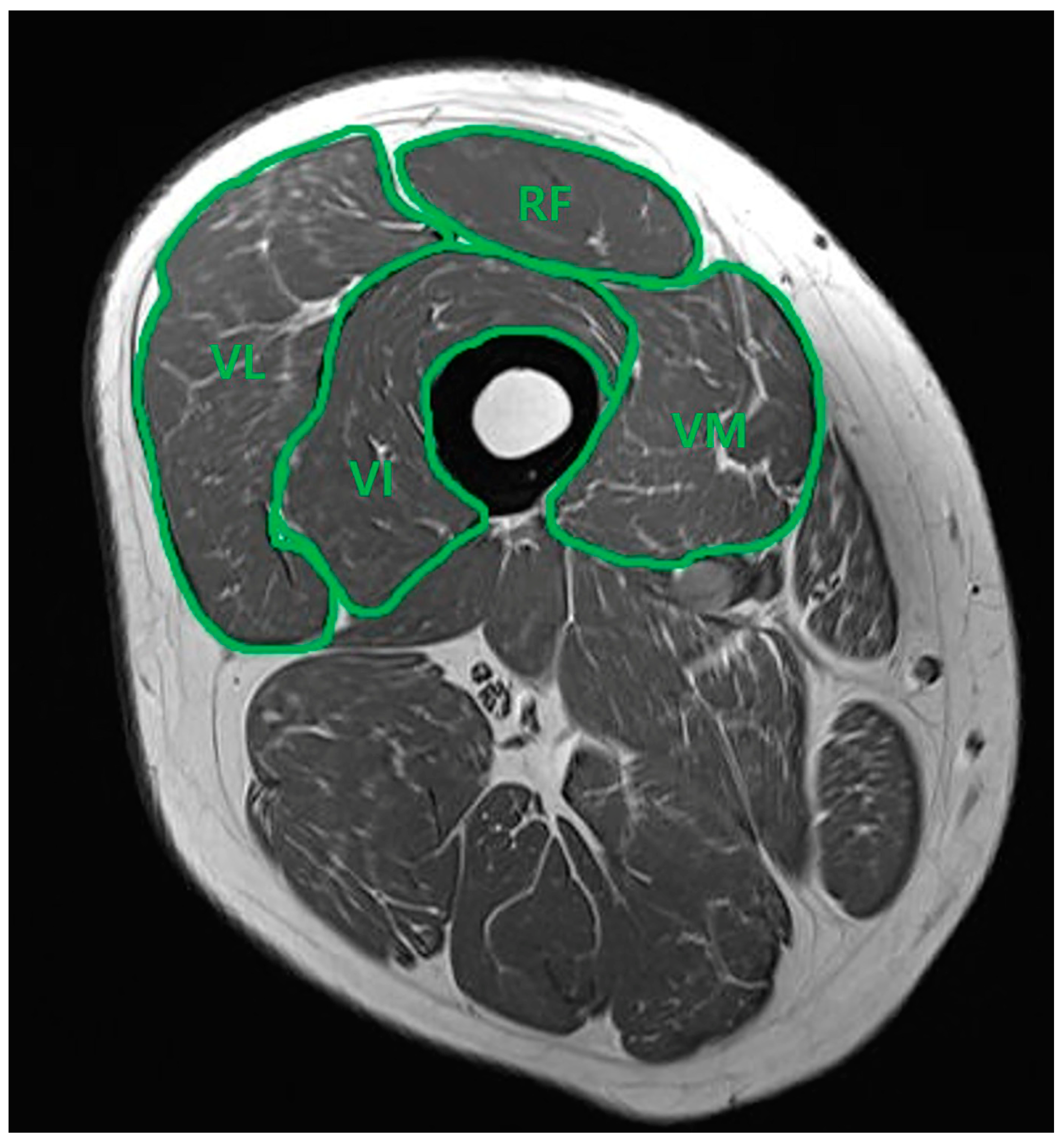 Medicina 60 01983 g001