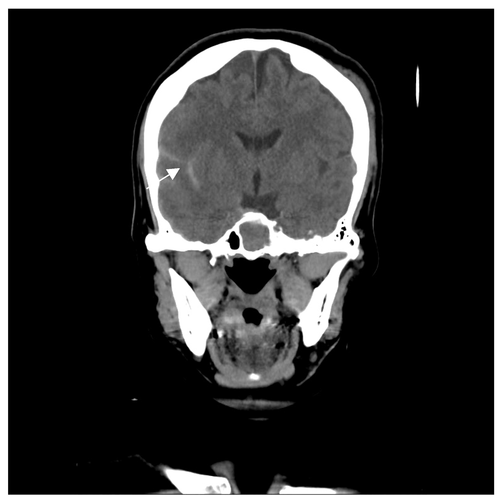 Medicina 60 02011 g001