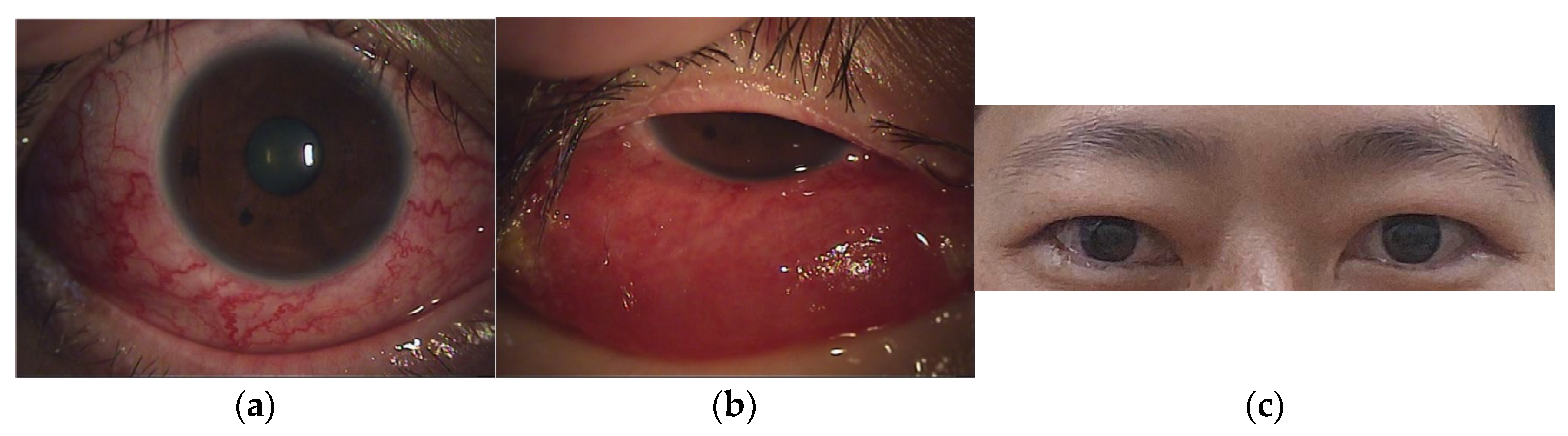 Medicina 60 02011 g002