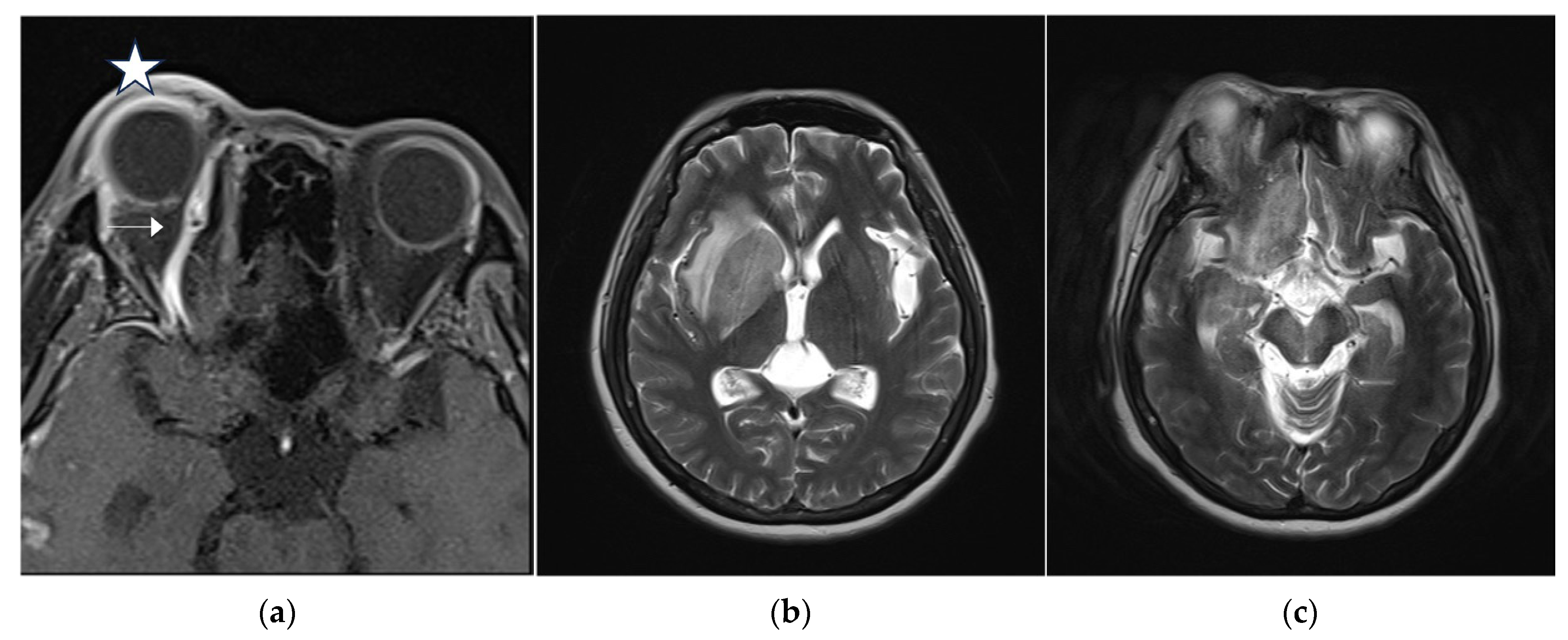 Medicina 60 02011 g003
