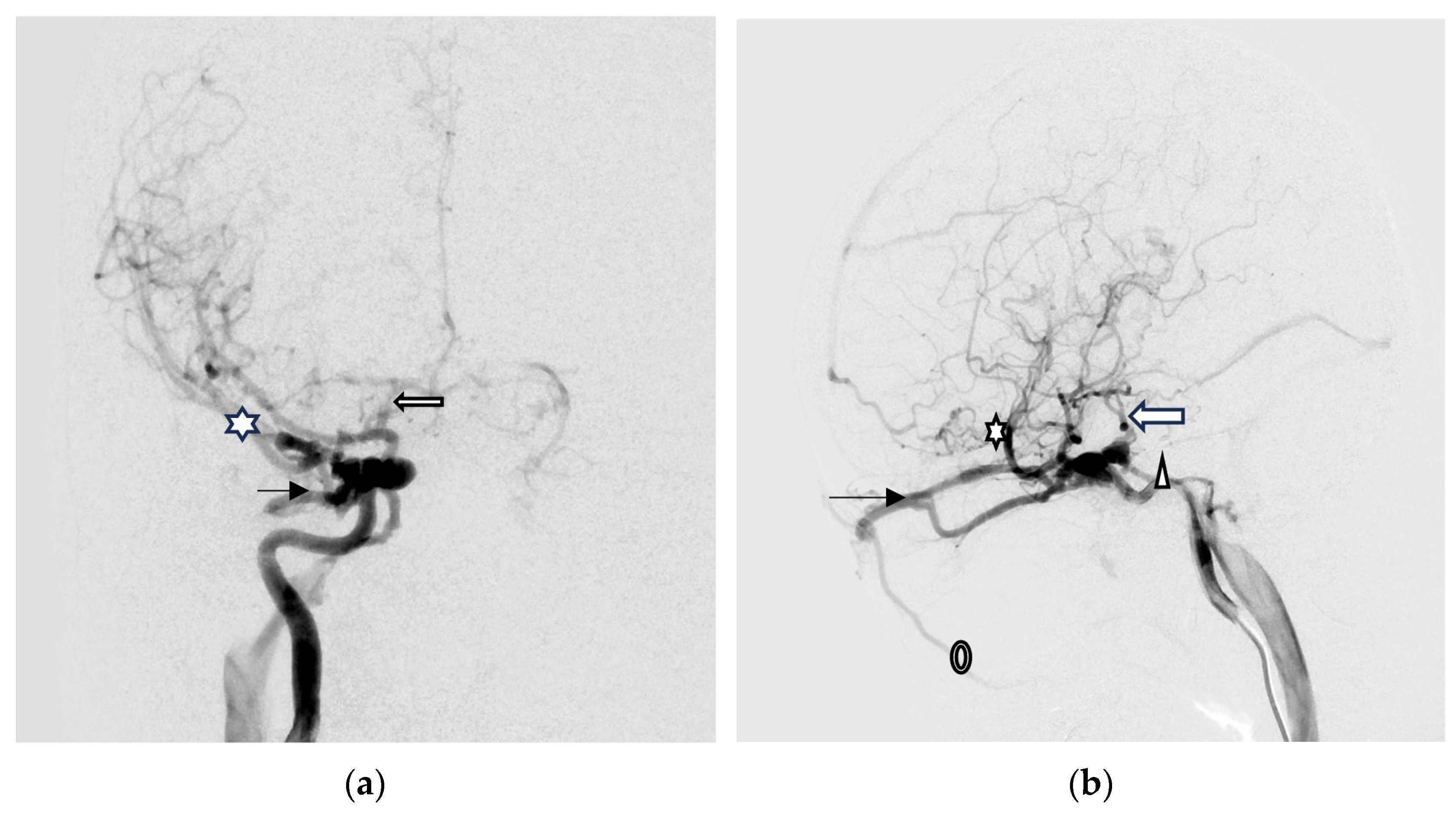 Medicina 60 02011 g004a