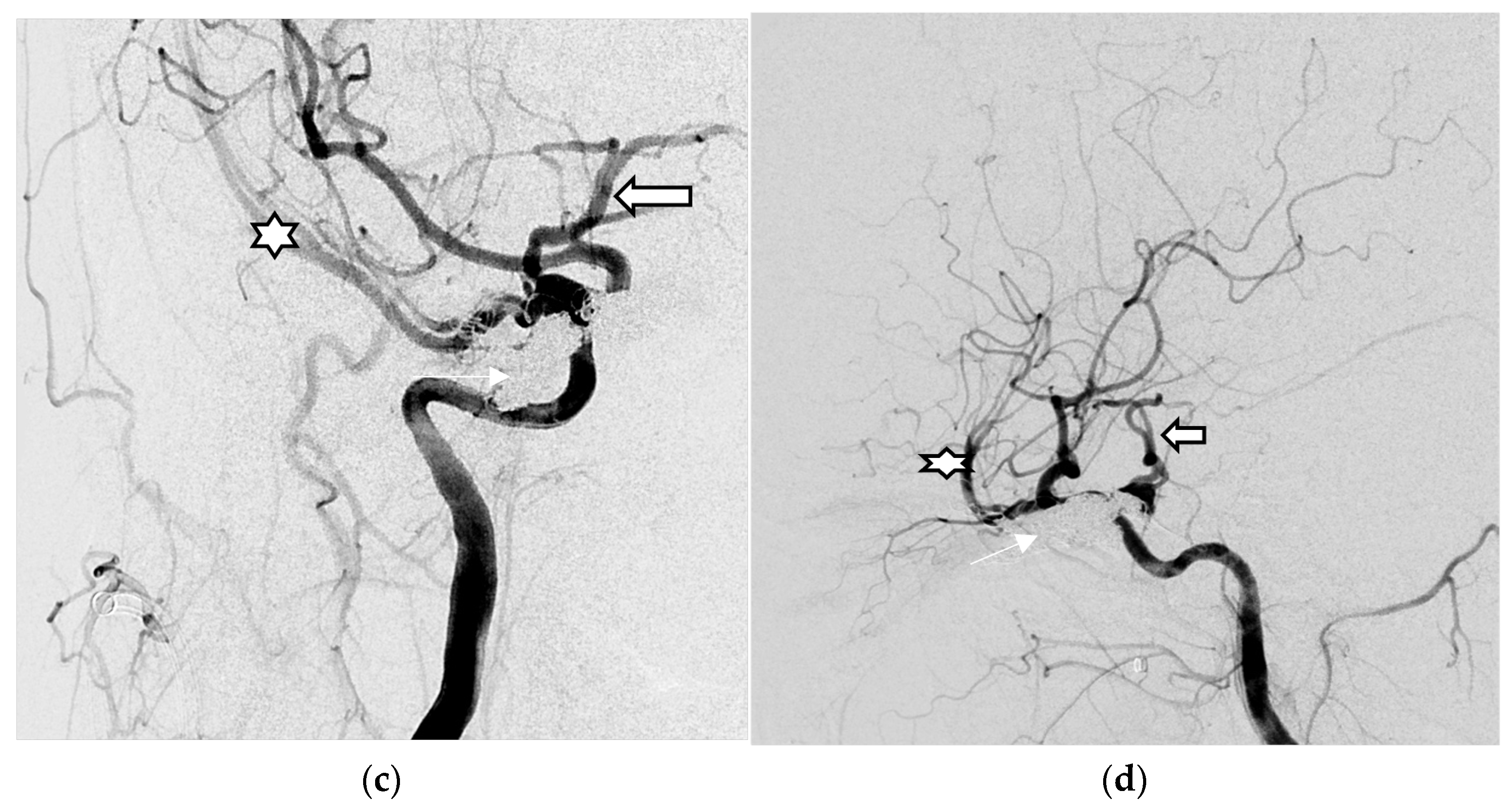 Medicina 60 02011 g004b