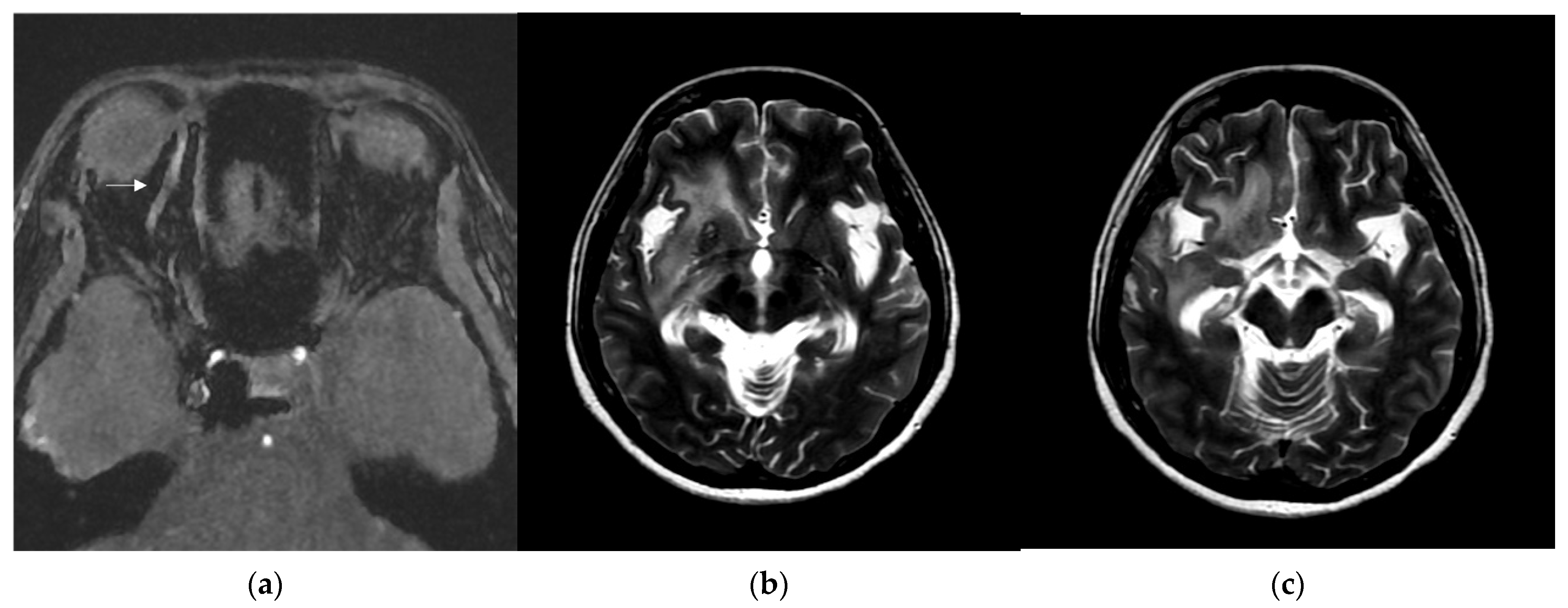 Medicina 60 02011 g005