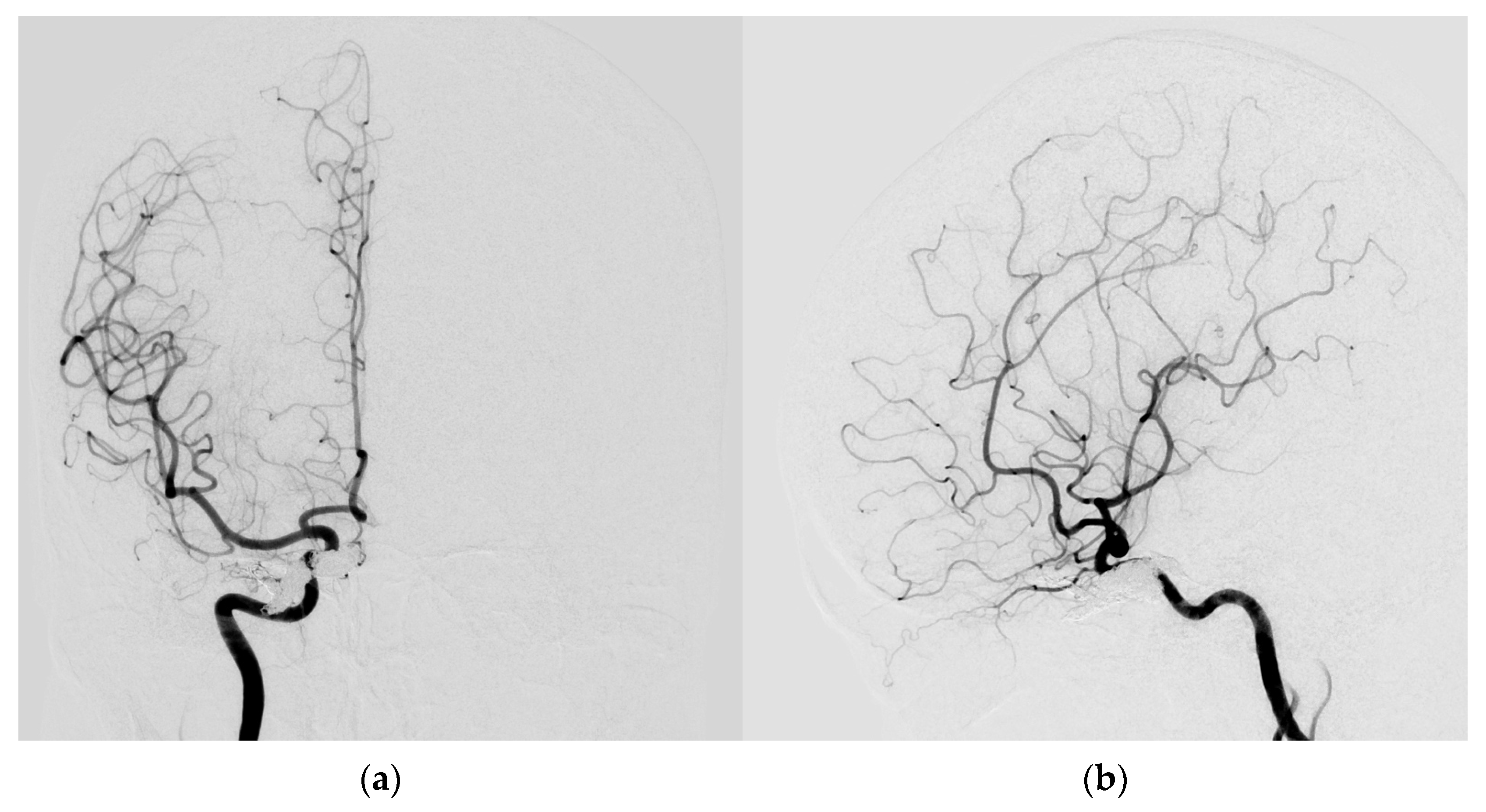Medicina 60 02011 g006