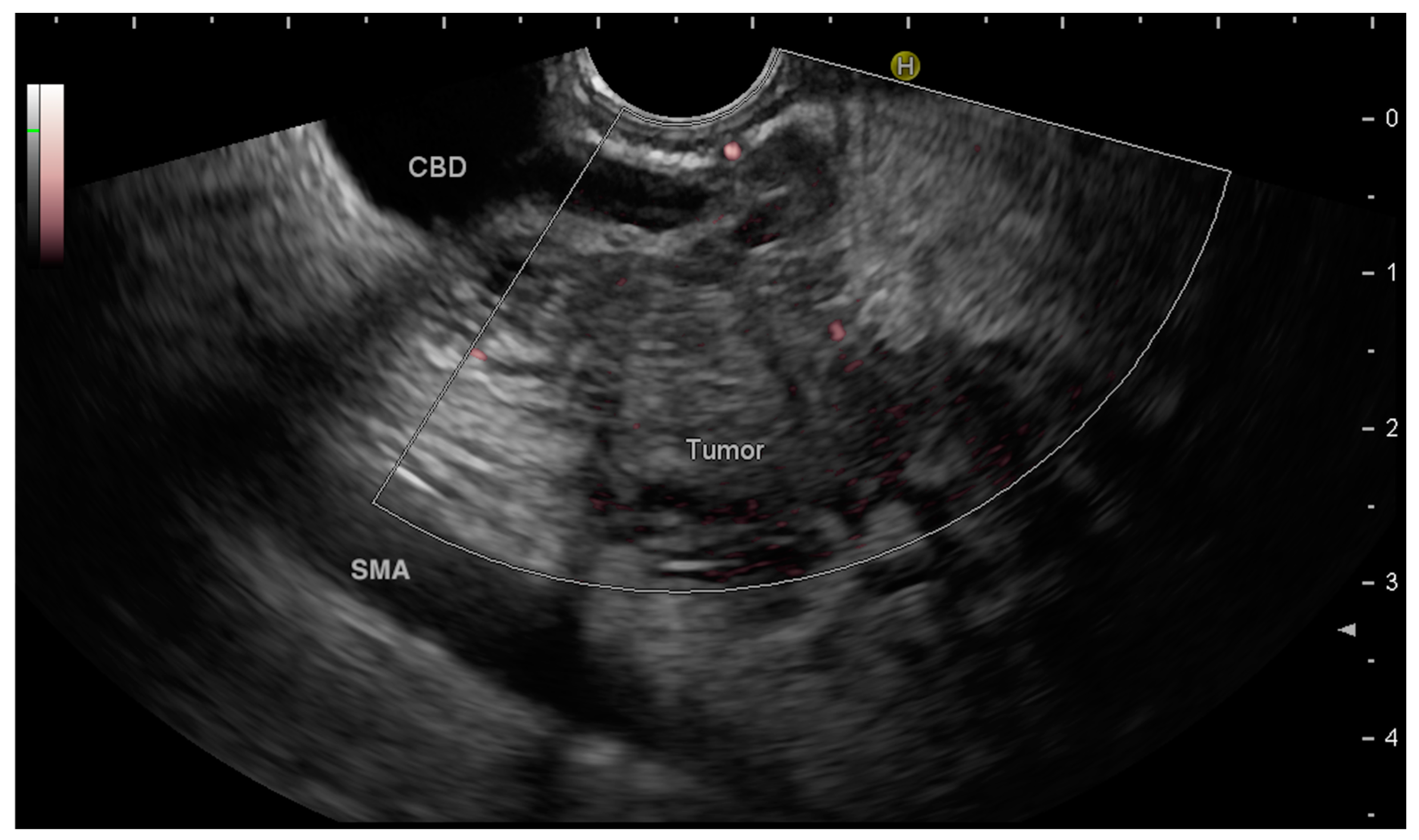 Medicina 60 02021 g001 Medicina 60 02021 g001
