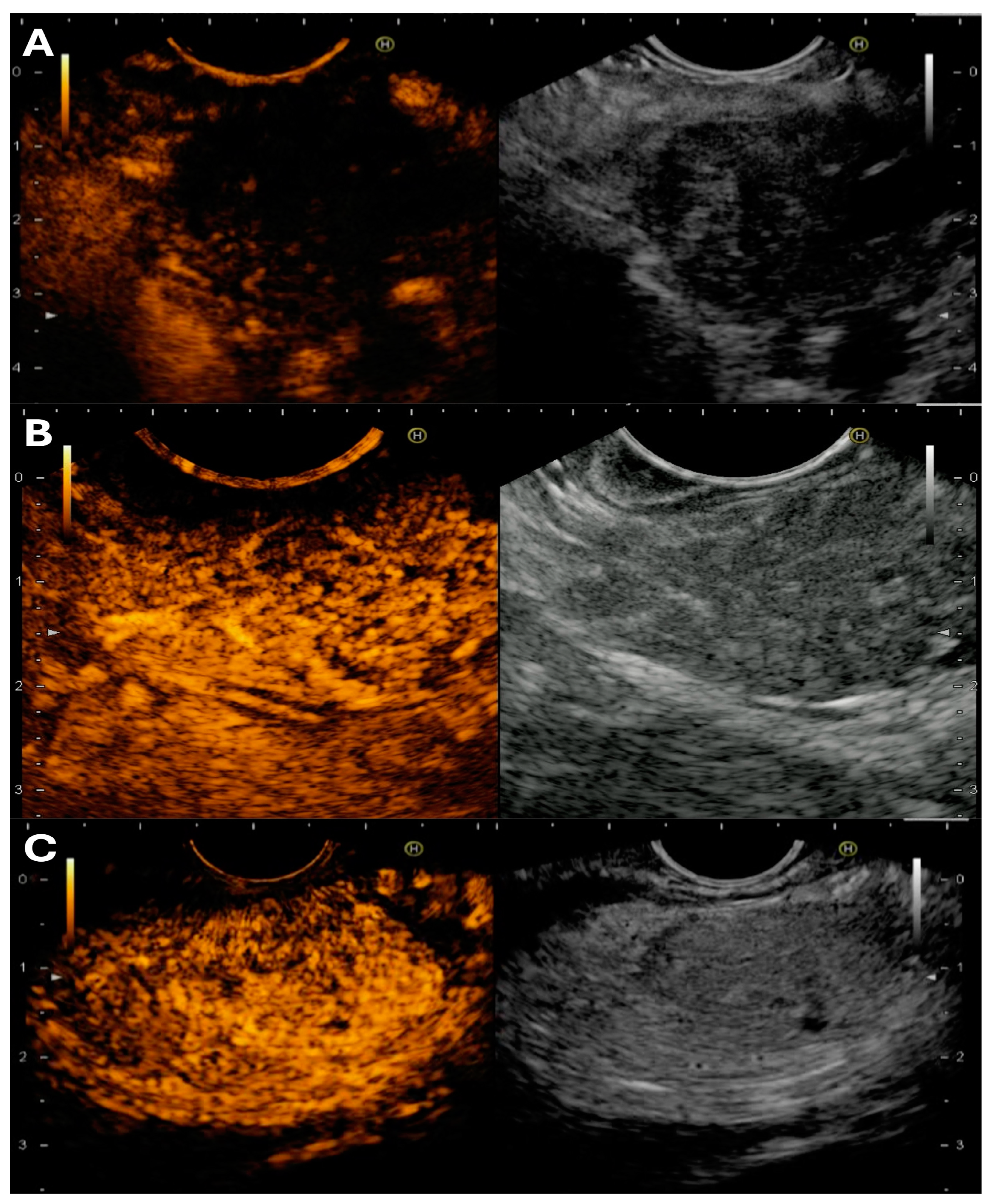 Medicina 60 02021 g002 Medicina 60 02021 g002