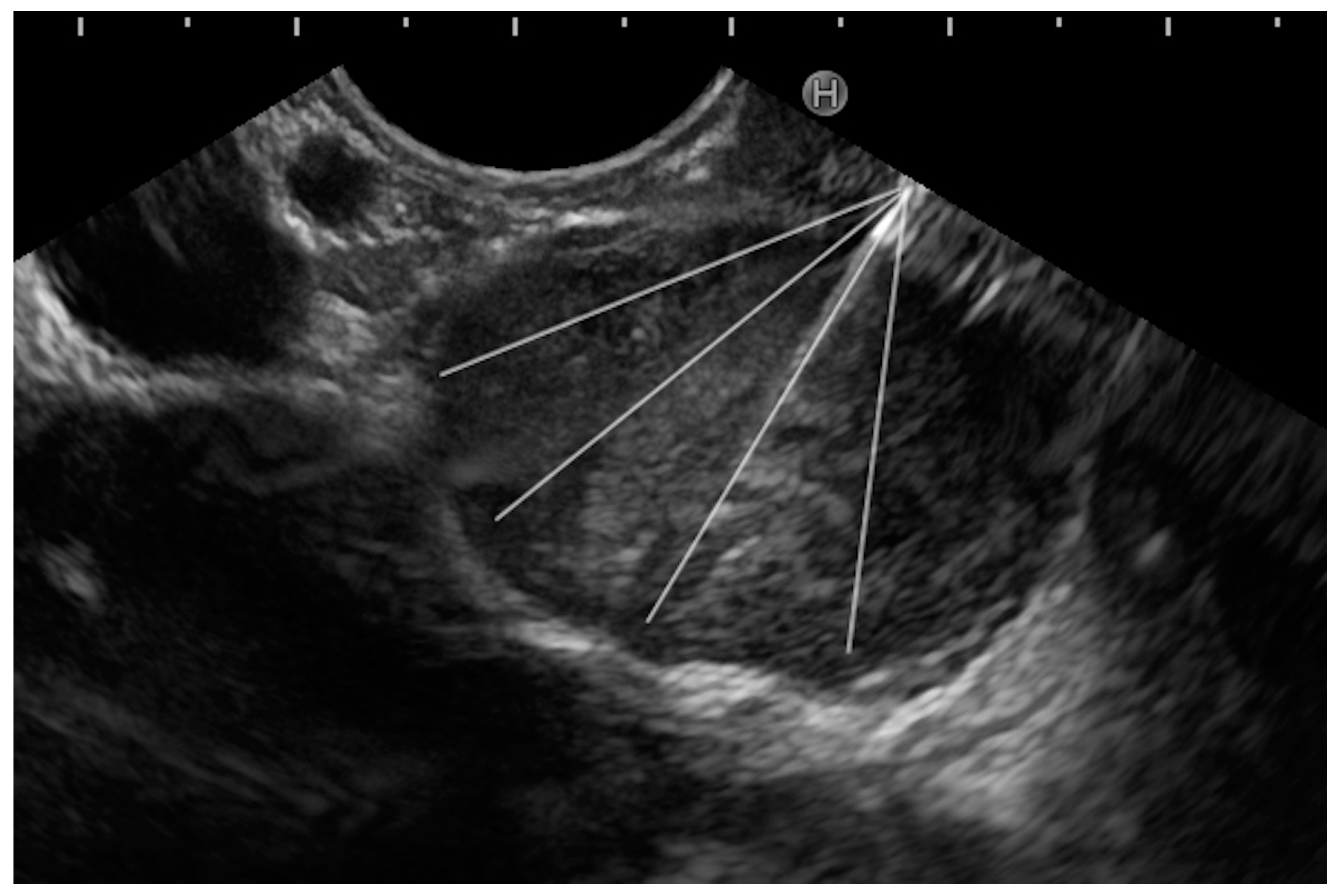 Medicina 60 02021 g005 Medicina 60 02021 g005