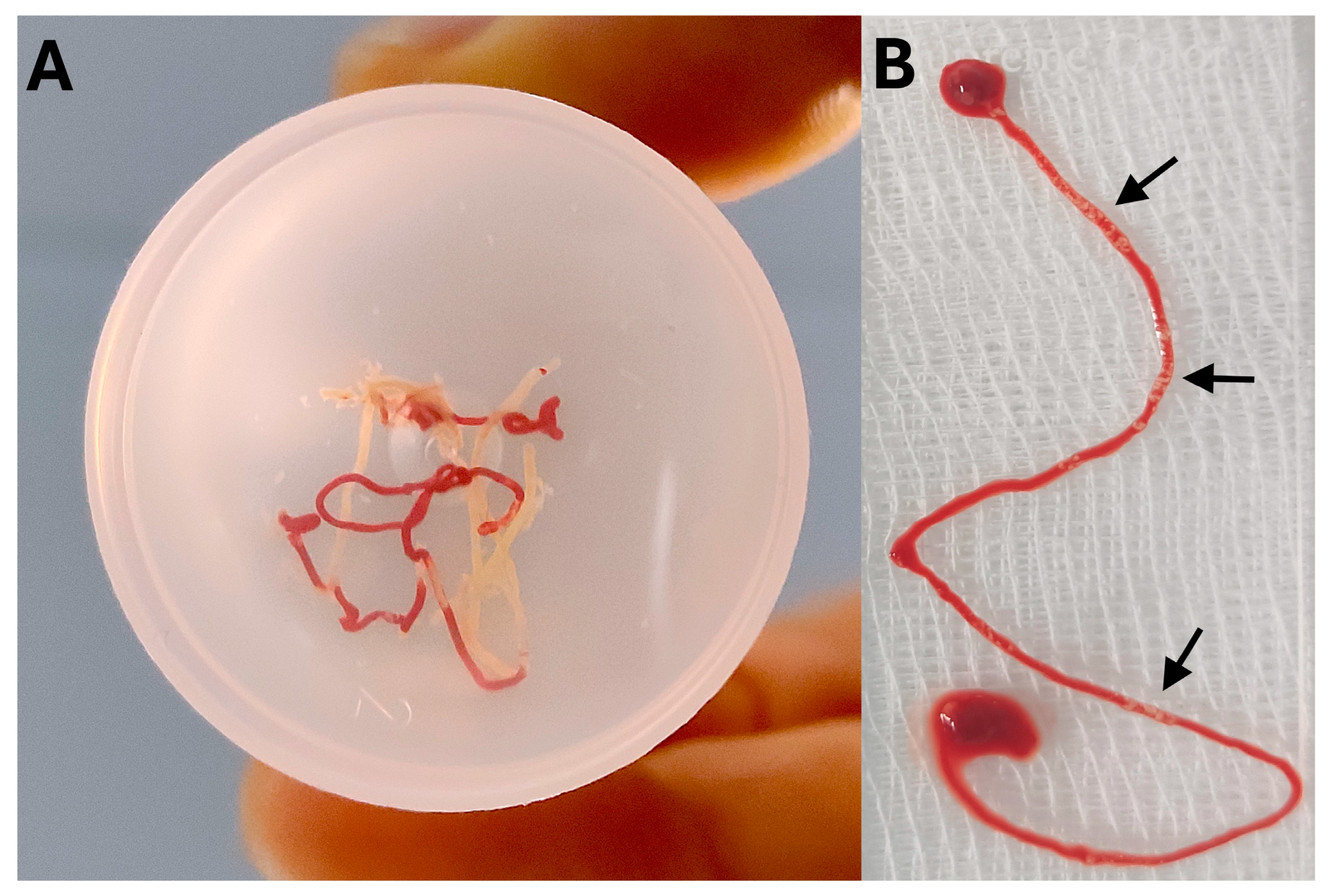 Medicina 60 02021 g006 Medicina 60 02021 g006