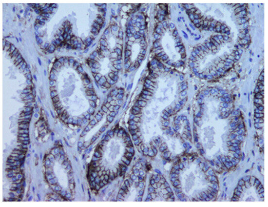 Medicina 60 02032 g002