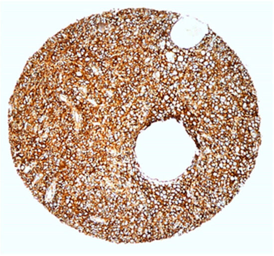 Medicina 60 02032 g003