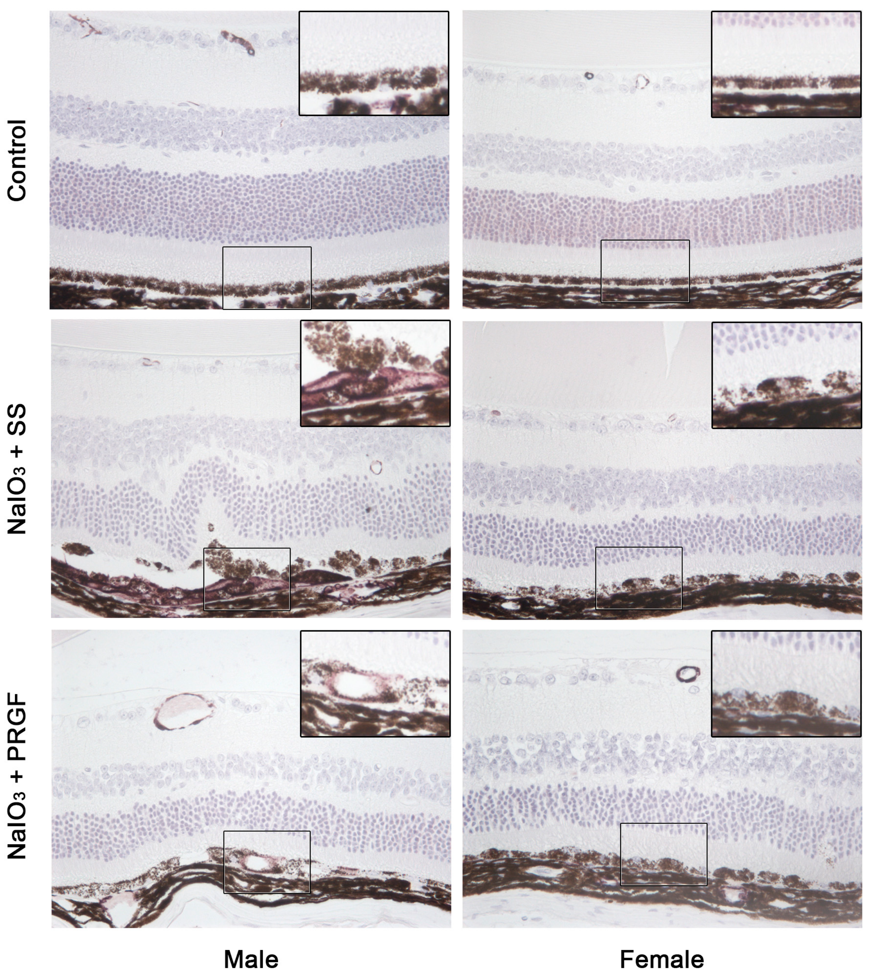 Medicina 60 02036 g004