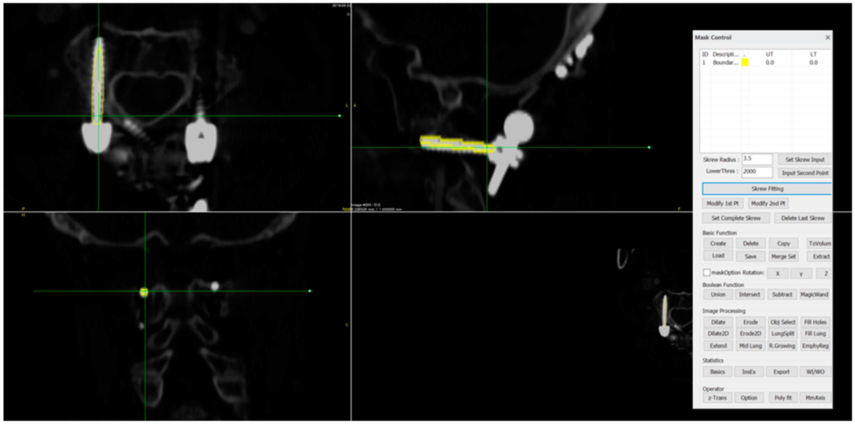 Medicina 60 02040 g005