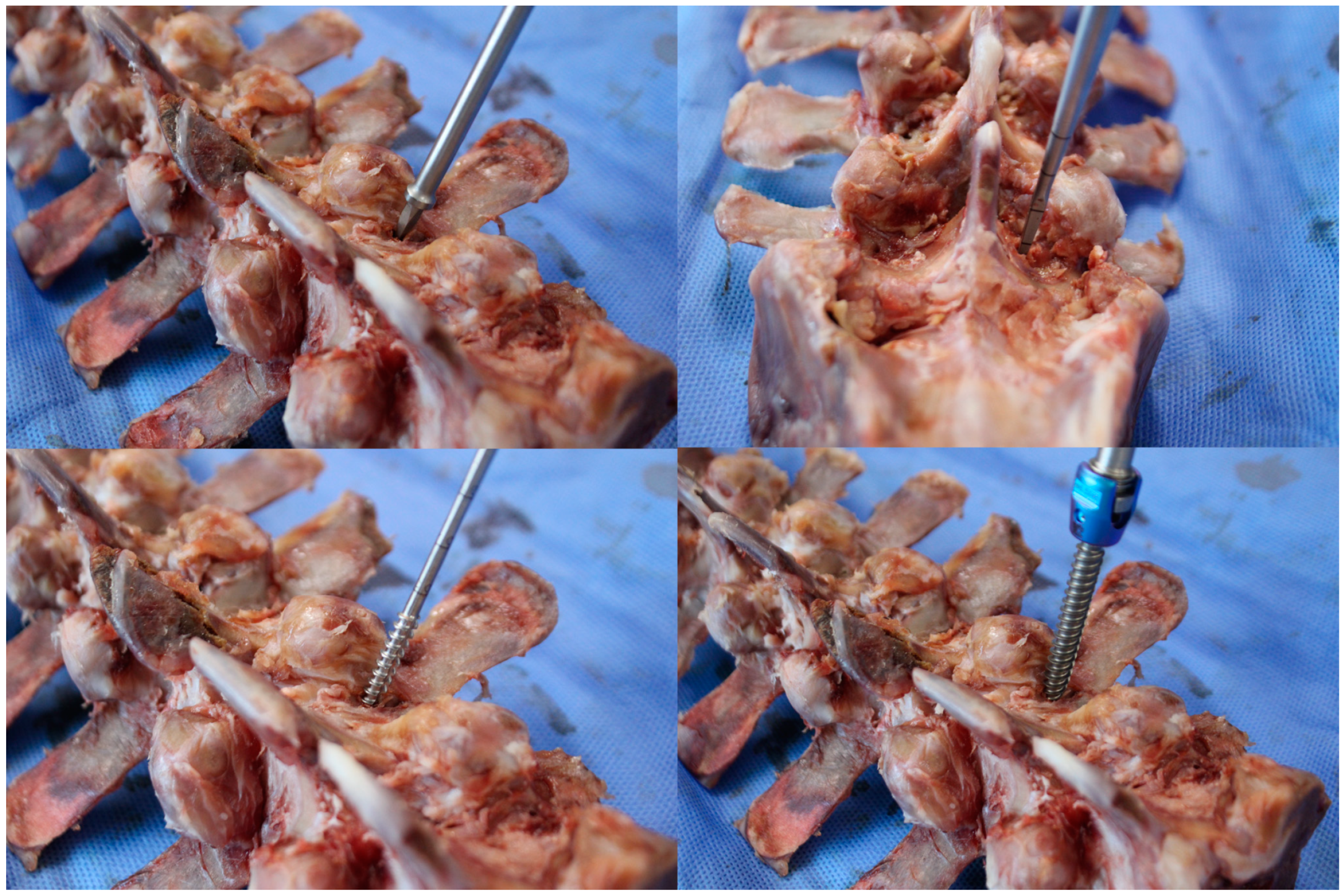 Medicina 60 02040 g006