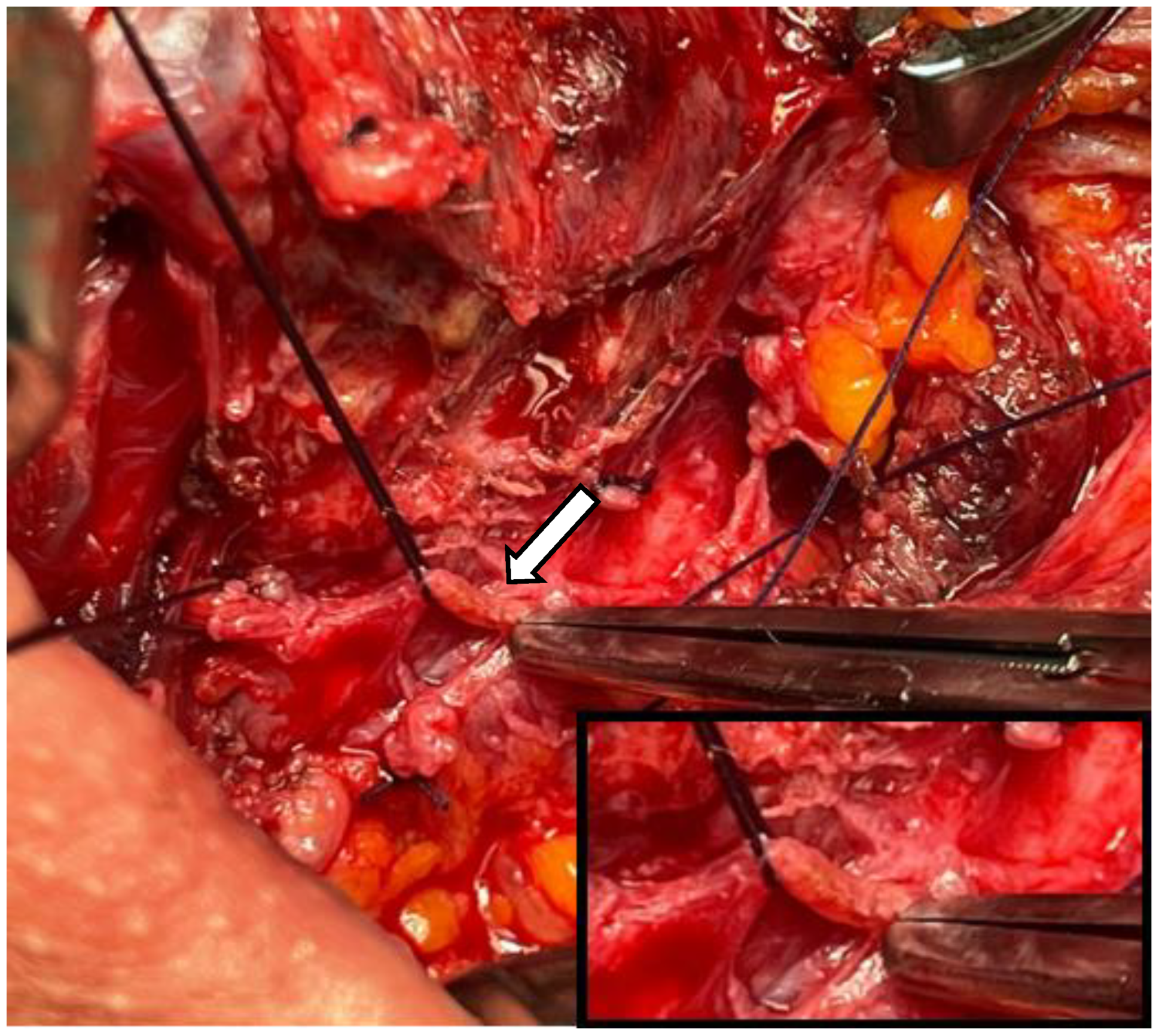 Medicina 60 02054 g002