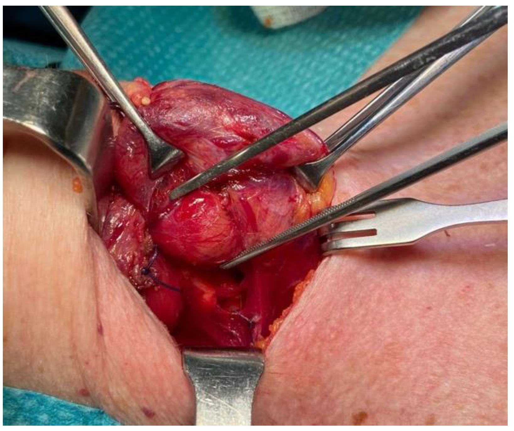 Medicina 60 02054 g003