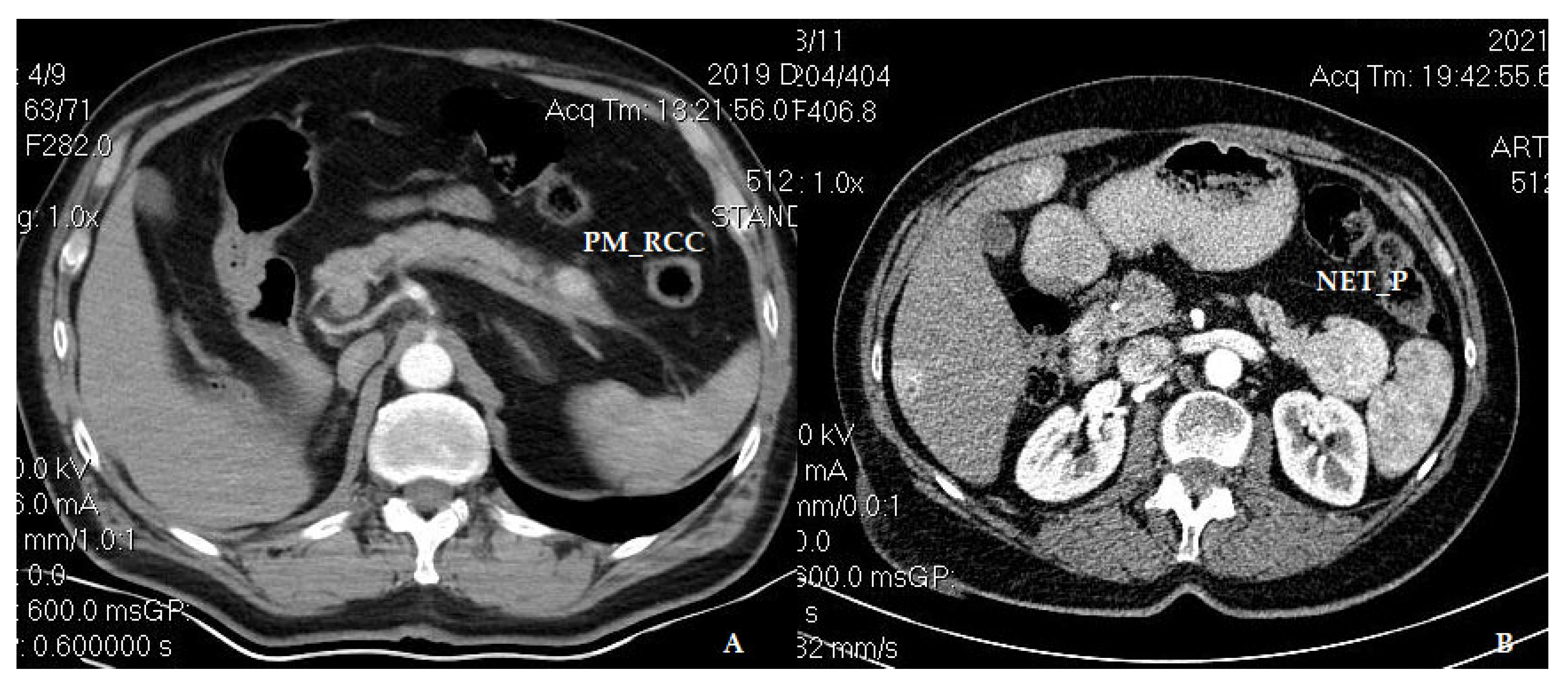 Medicina 60 02074 g005
