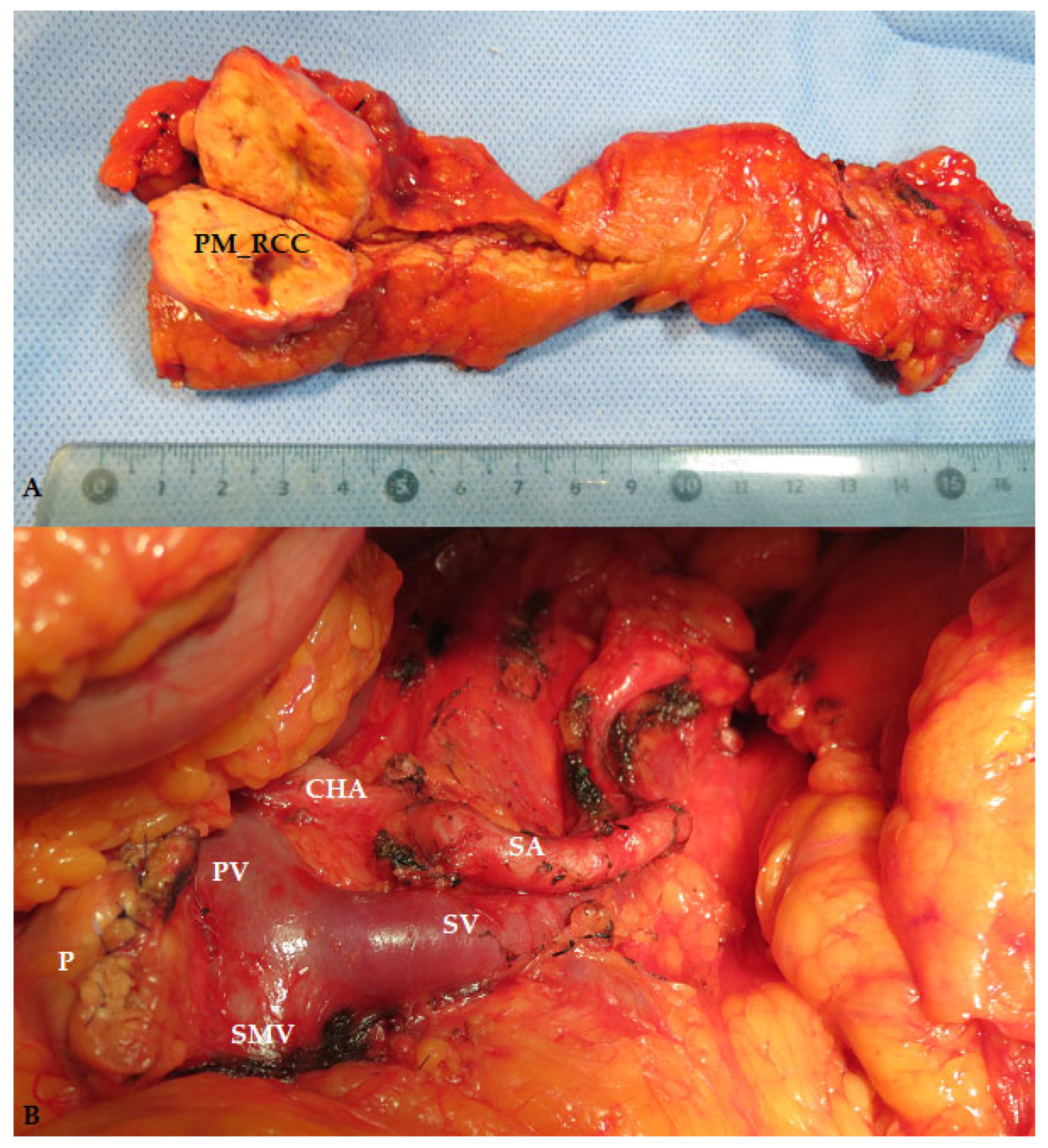 Medicina 60 02074 g006