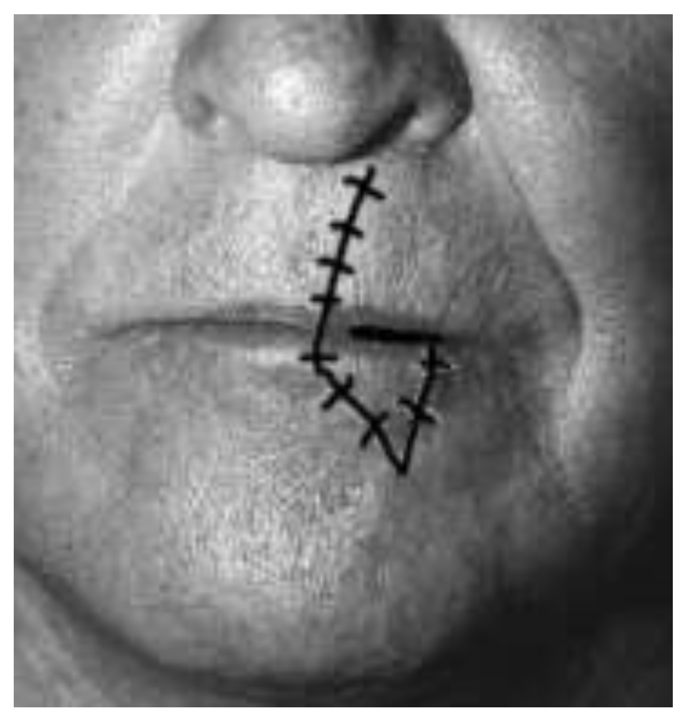 Medicina 61 00004 g002