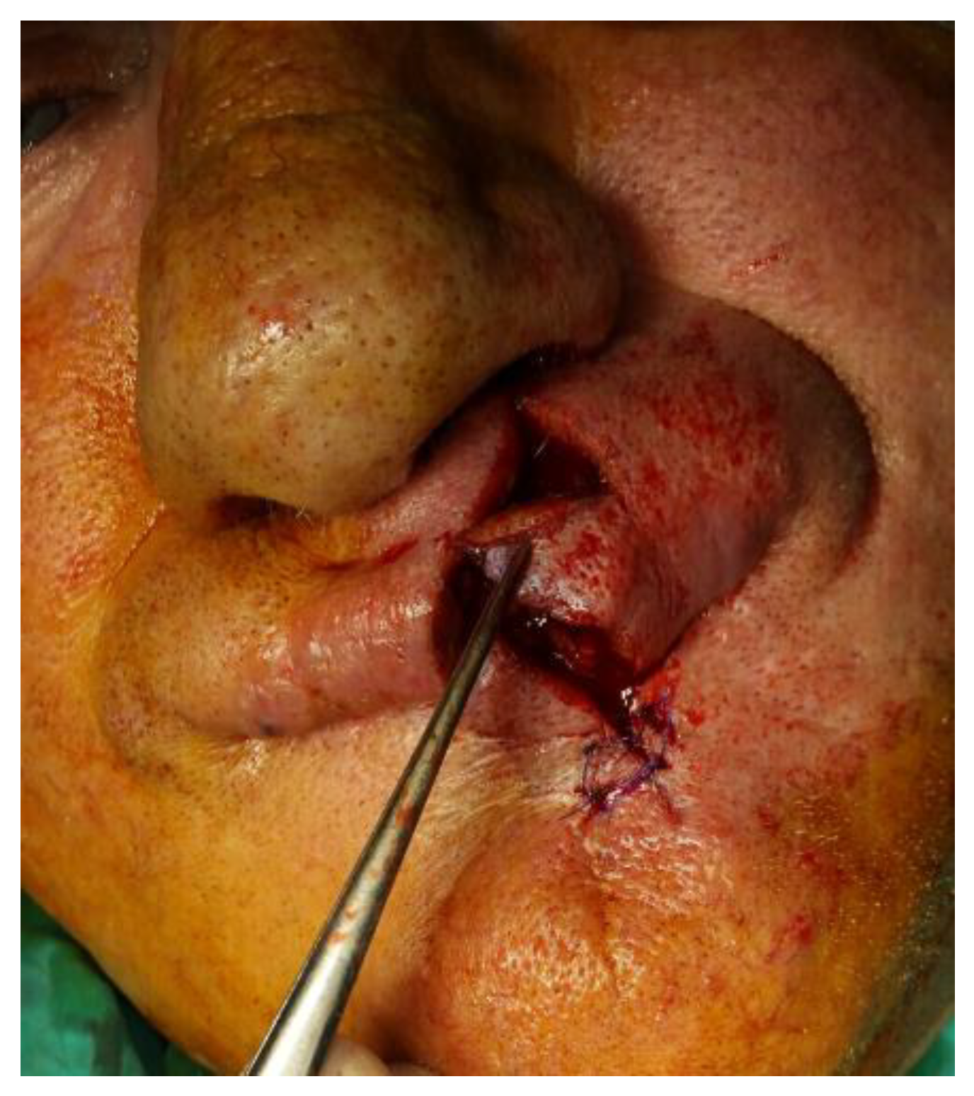 Medicina 61 00004 g004