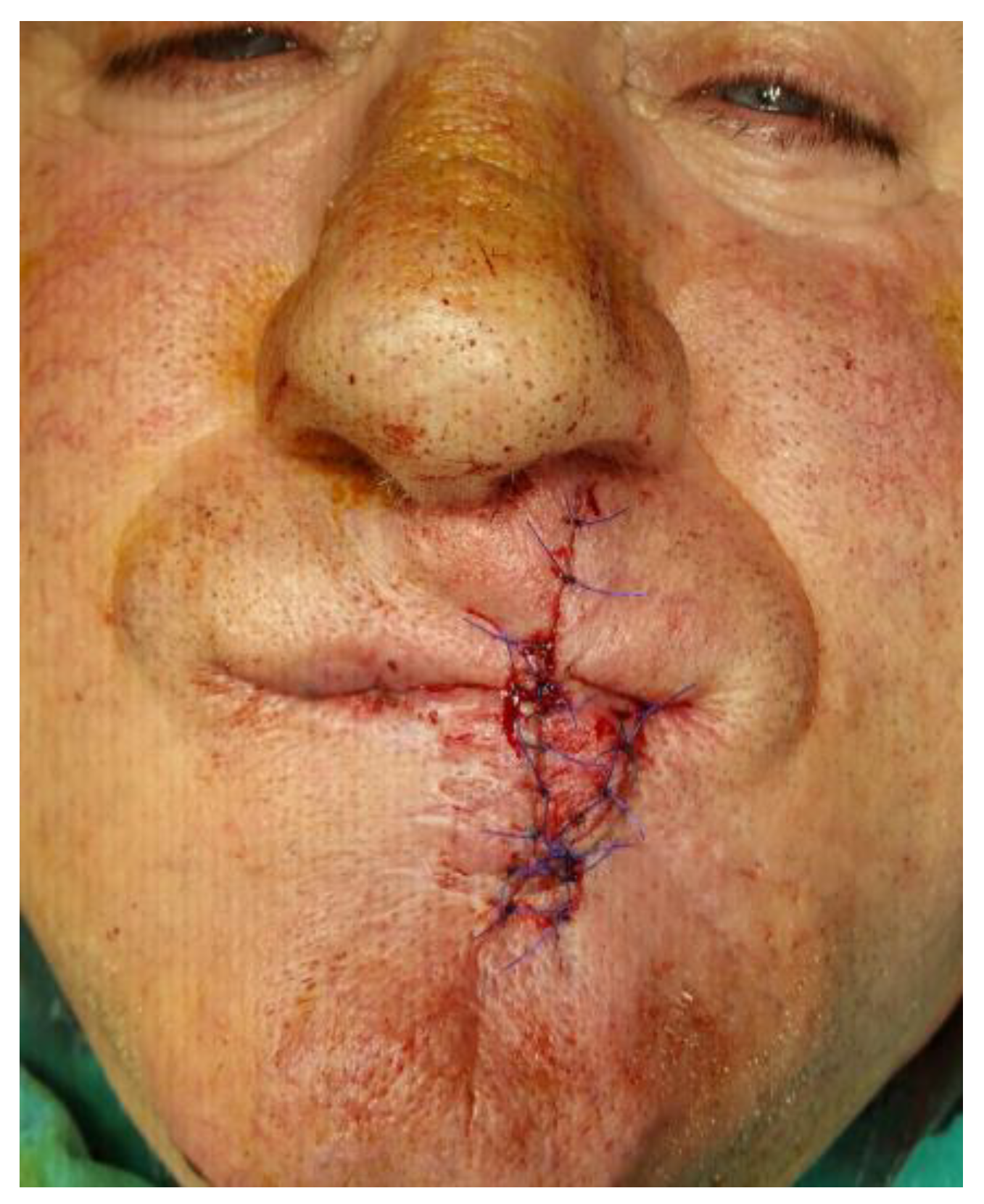 Medicina 61 00004 g006