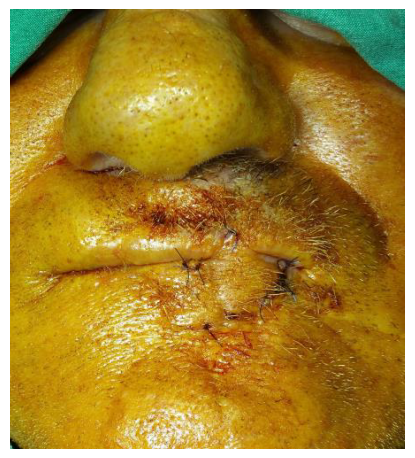 Medicina 61 00004 g007