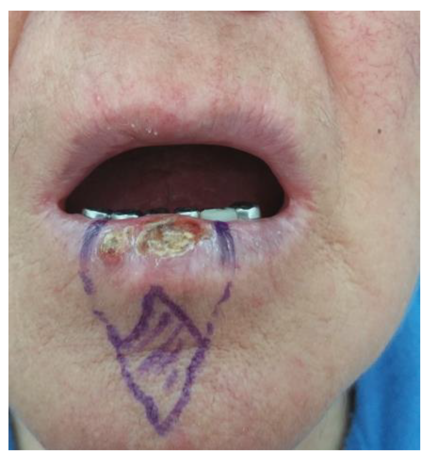 Medicina 61 00004 g011