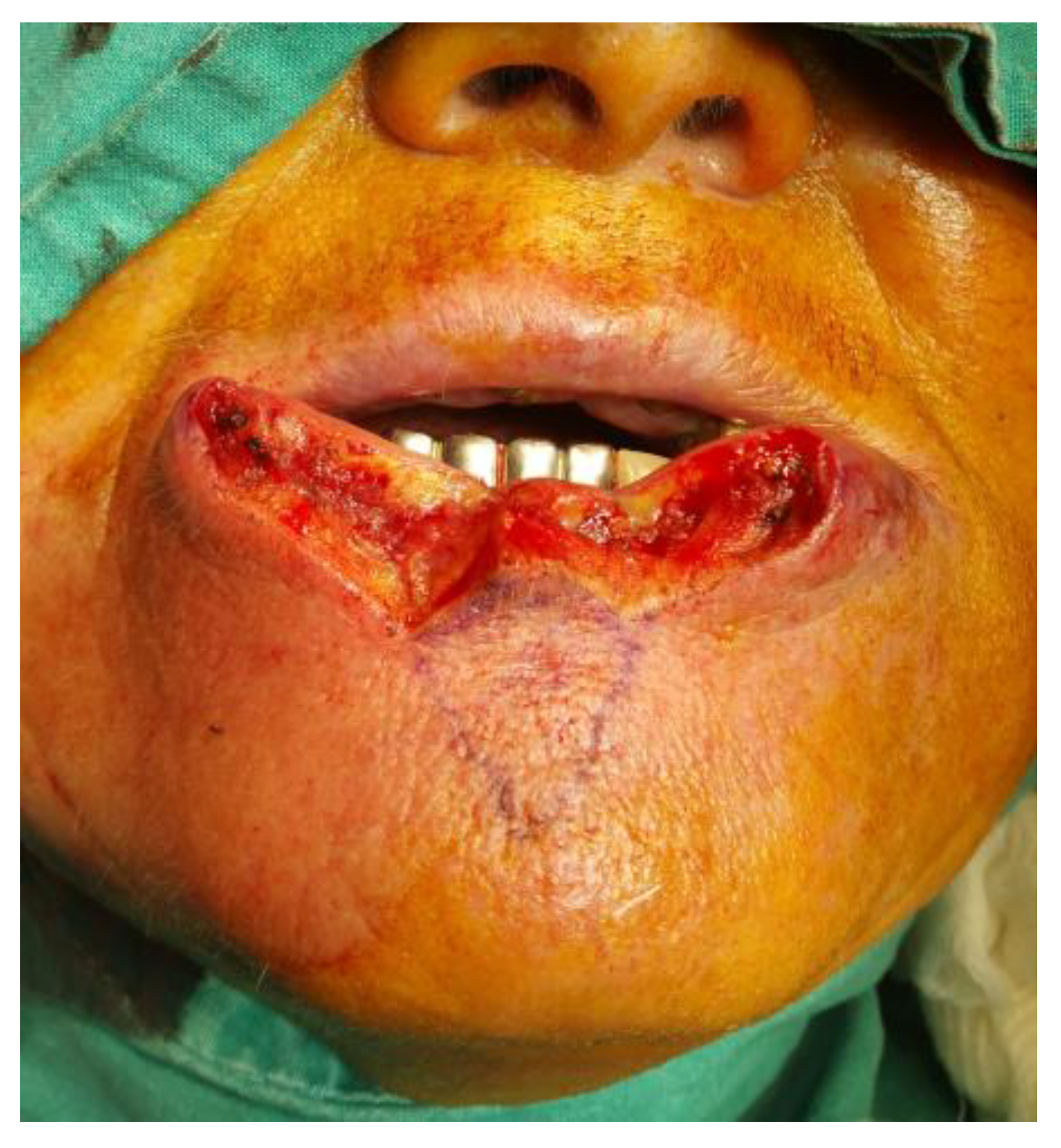 Medicina 61 00004 g012