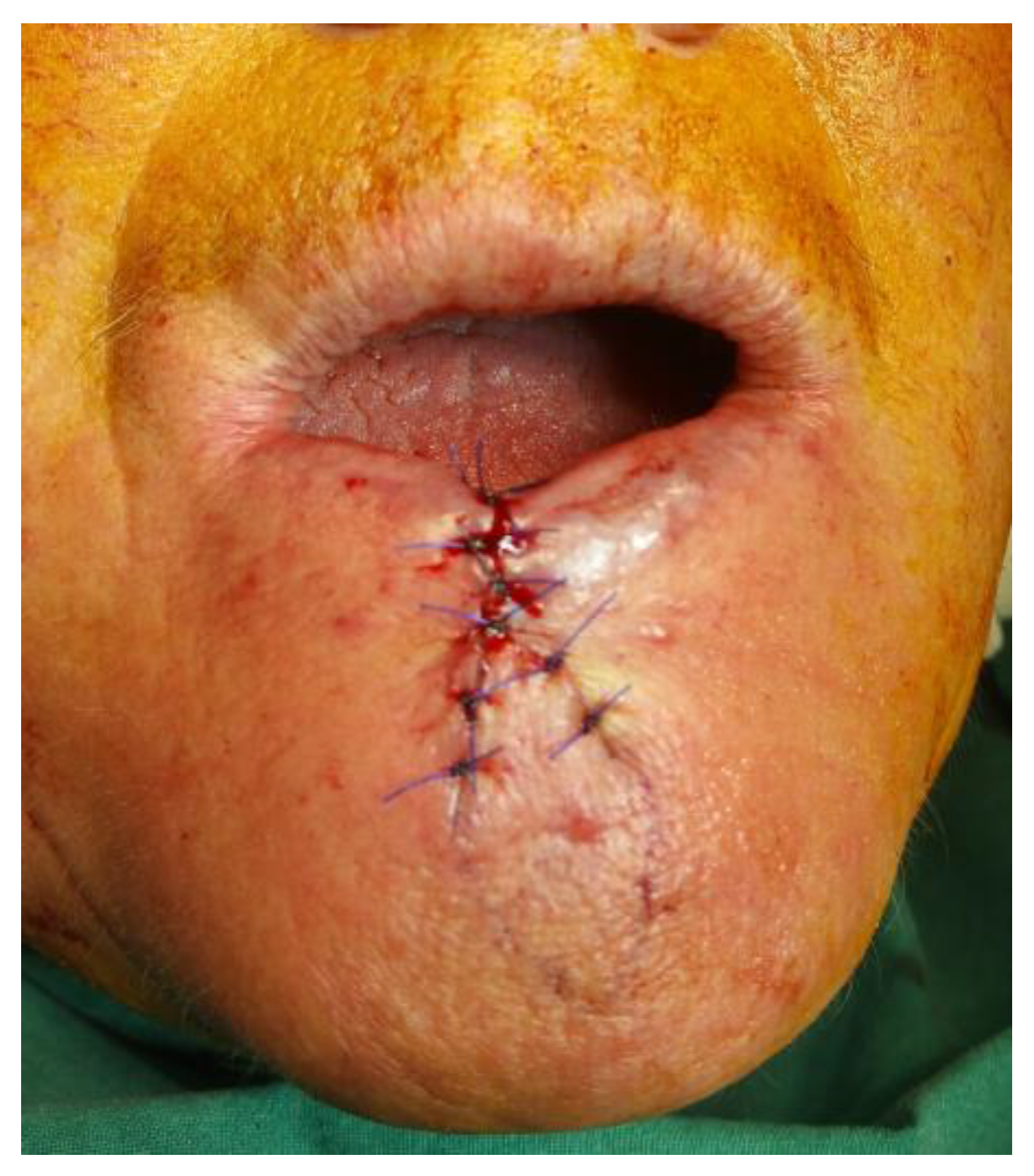 Medicina 61 00004 g014