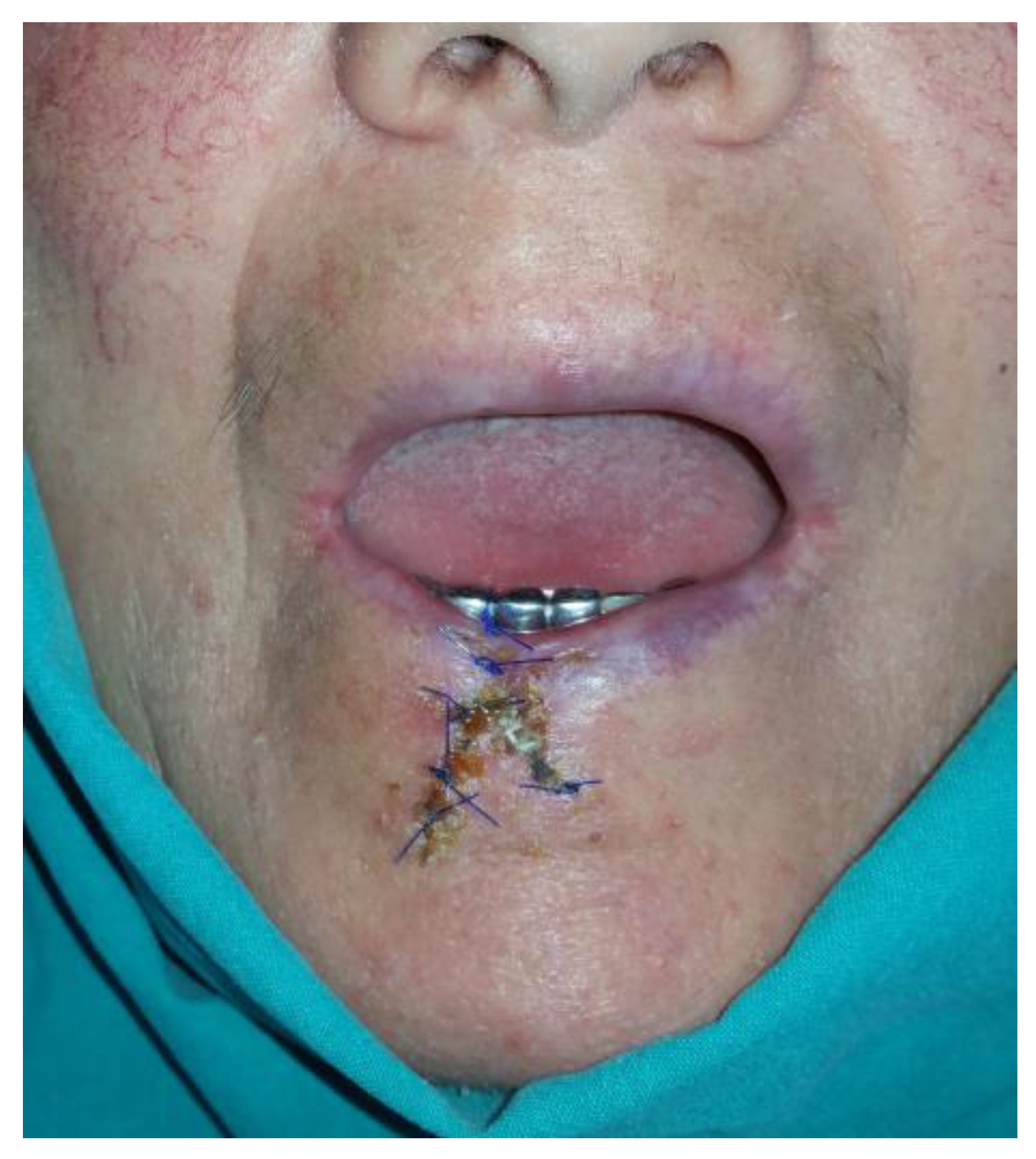 Medicina 61 00004 g015