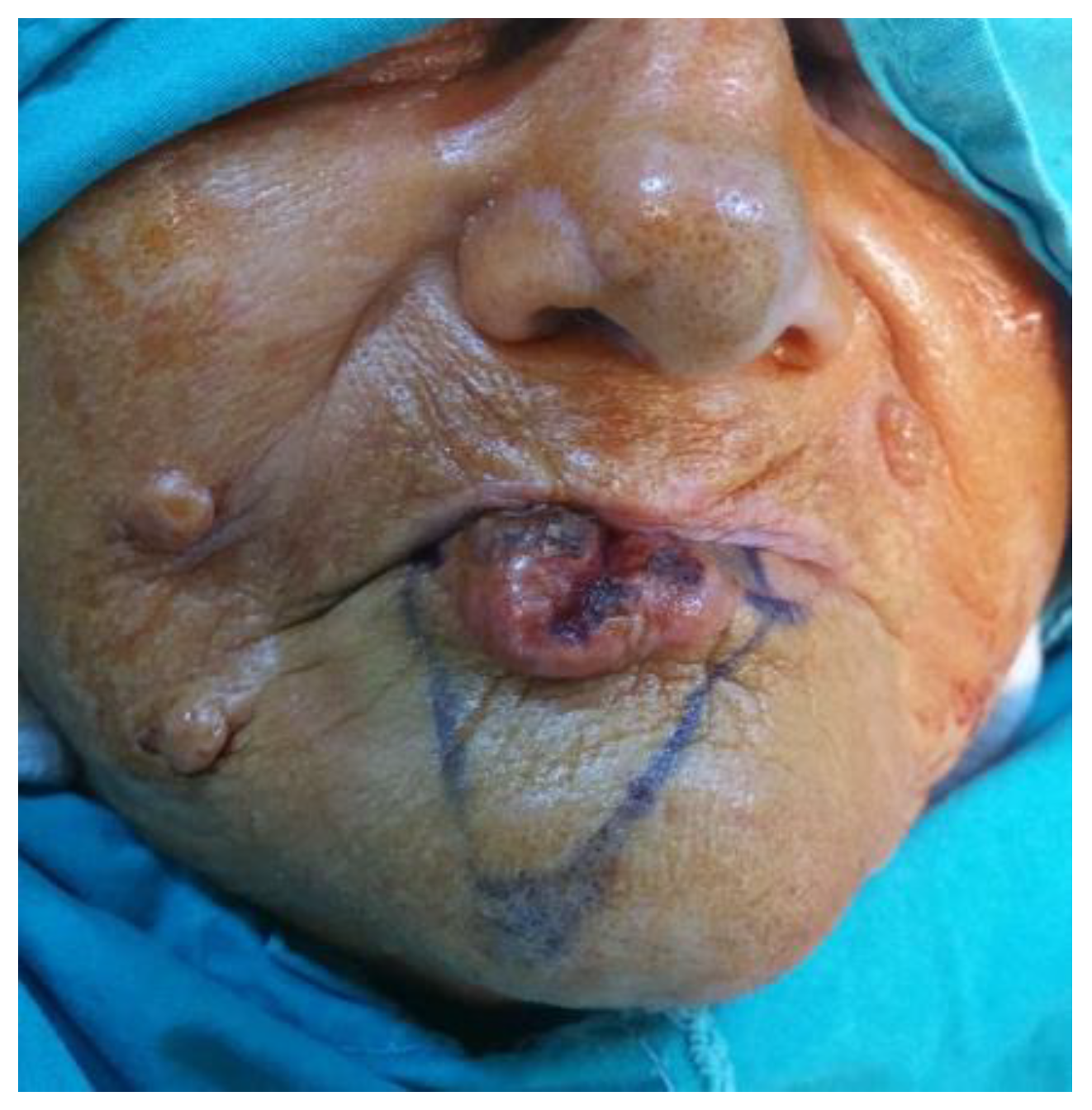 Medicina 61 00004 g018