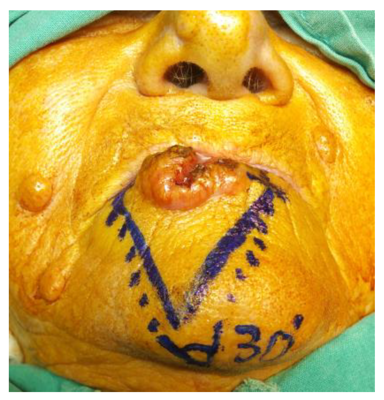 Medicina 61 00004 g019