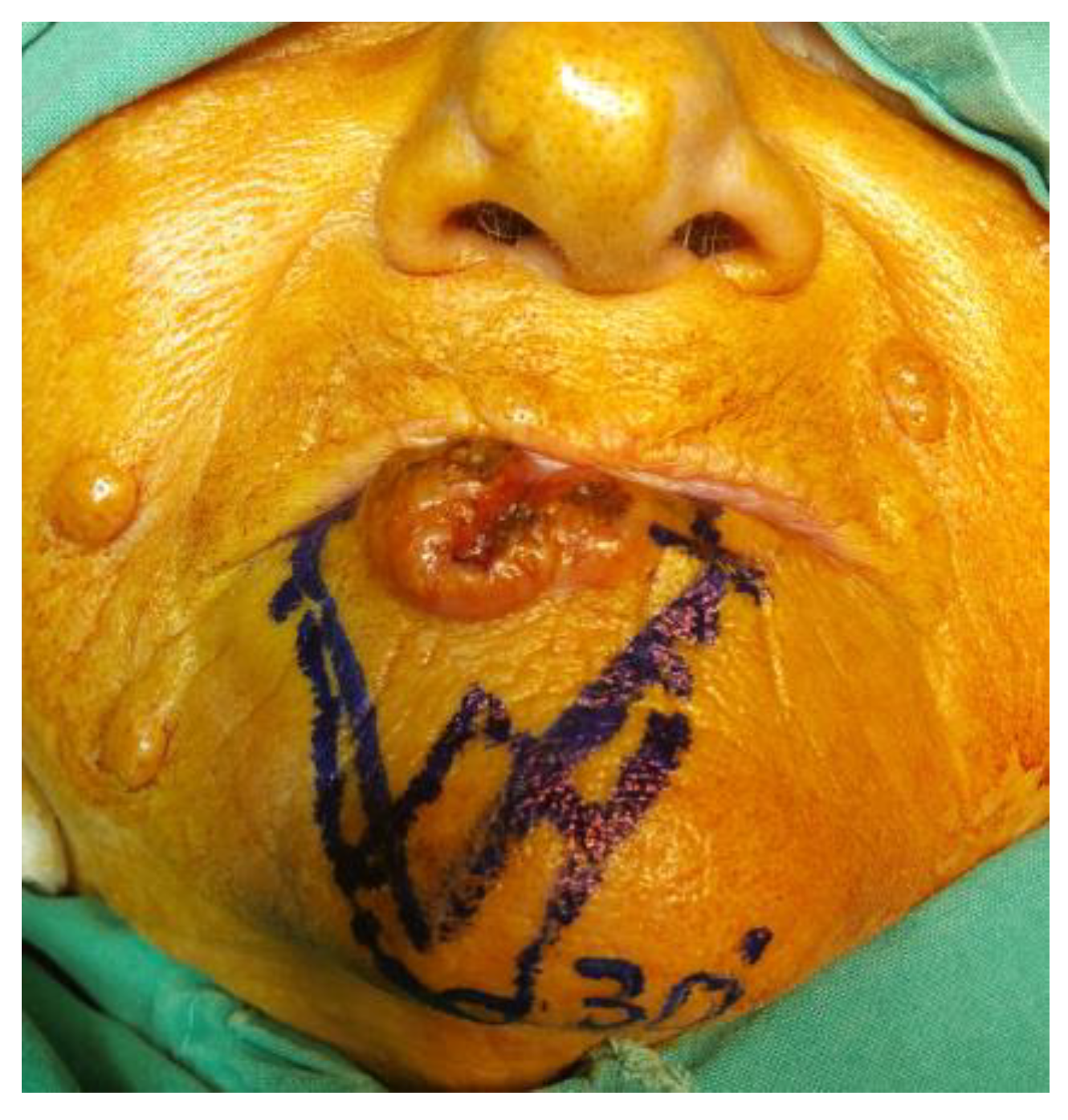 Medicina 61 00004 g020