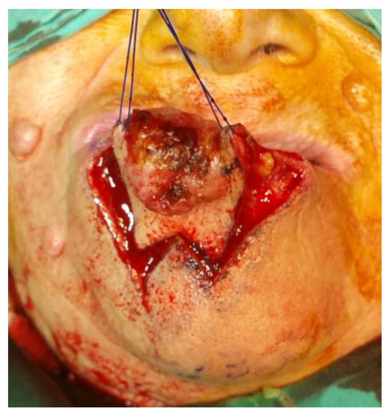 Medicina 61 00004 g021